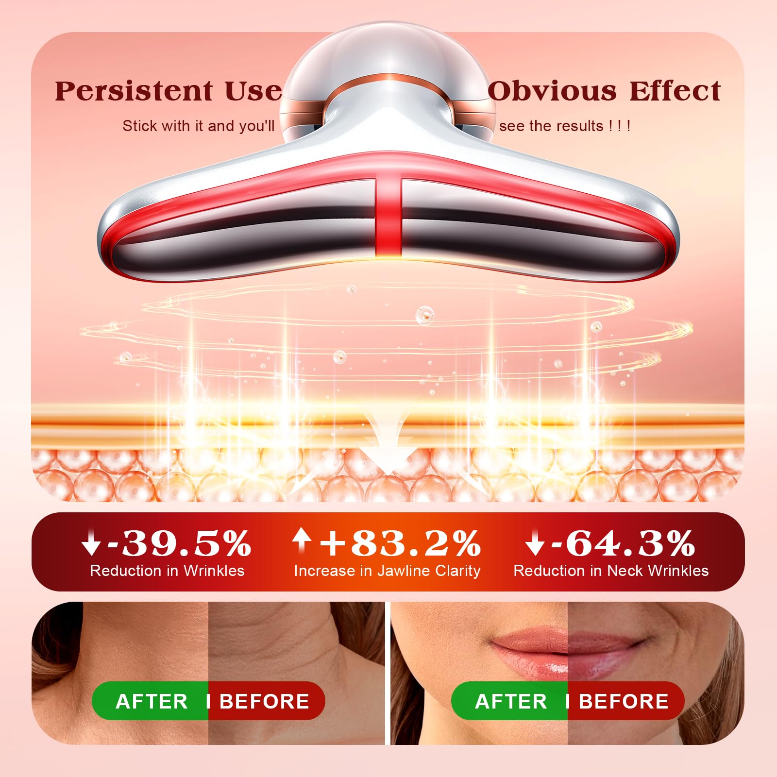 Pedete Facial Massager, 7 Colors Red Light Therapy for Face and Neck, Face Lift Device with 113°F Heating Vibration for Multi Skin Care - Medaid International