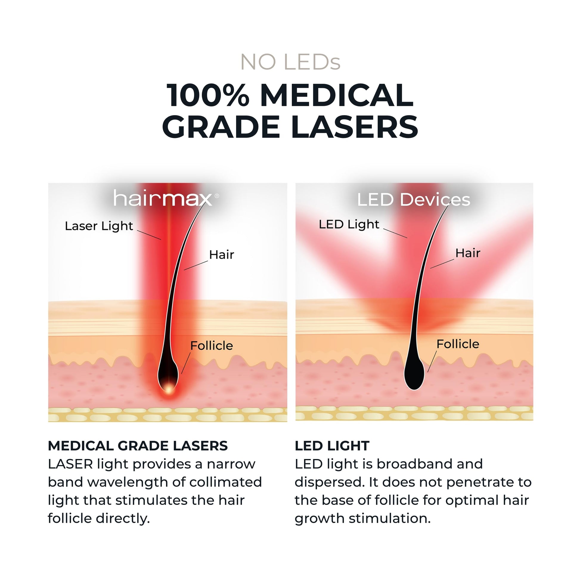 Hairmax RegrowMD FDA Cleared Laser Hair Growth Cap, Red Light Therapy for Hair Growth & Alopecia Areata Treatment, 30 Min Sessions, For Men & Women - Medaid International