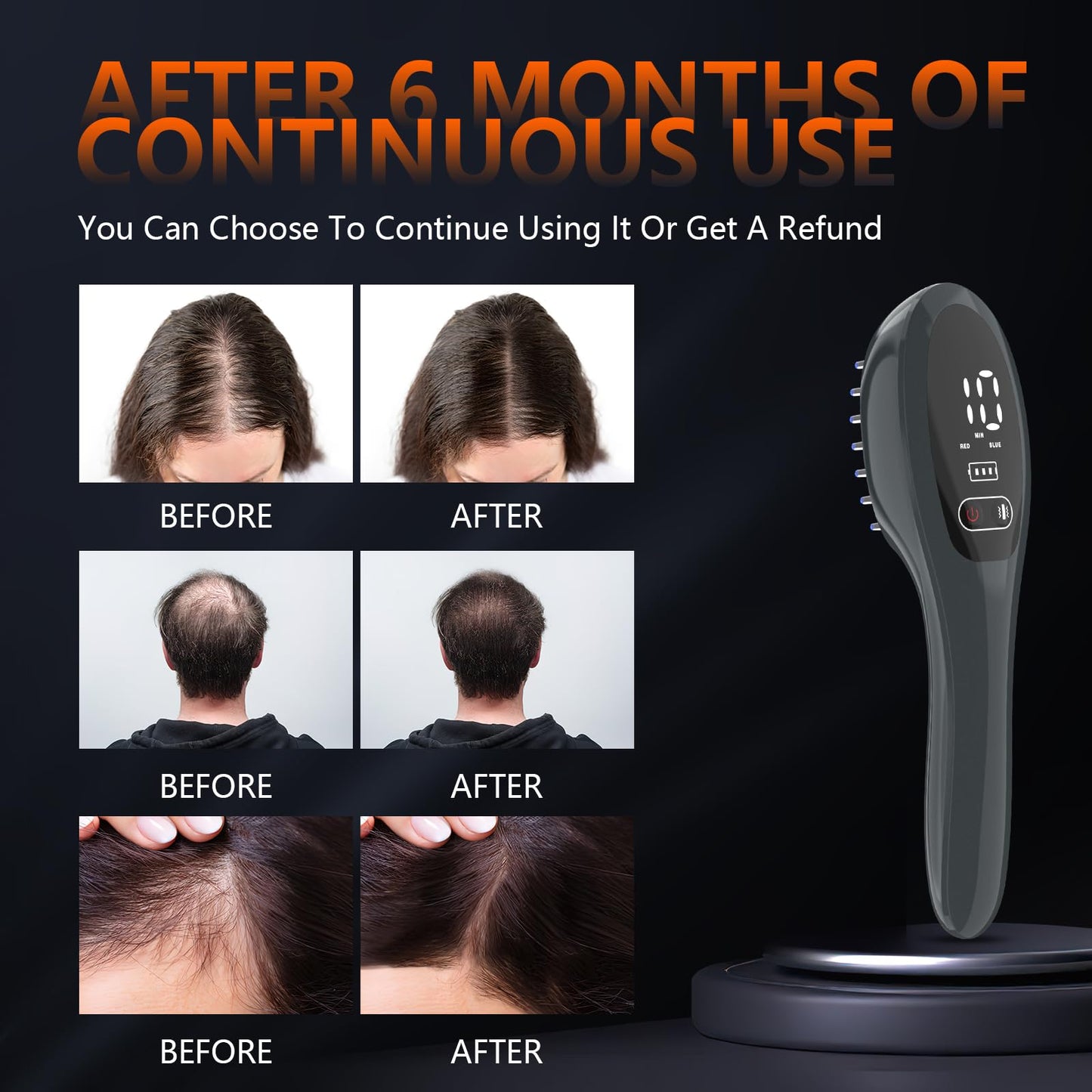 Laser Therapy Hair Growth Comb, red light therapy for hair growth - Medaid International