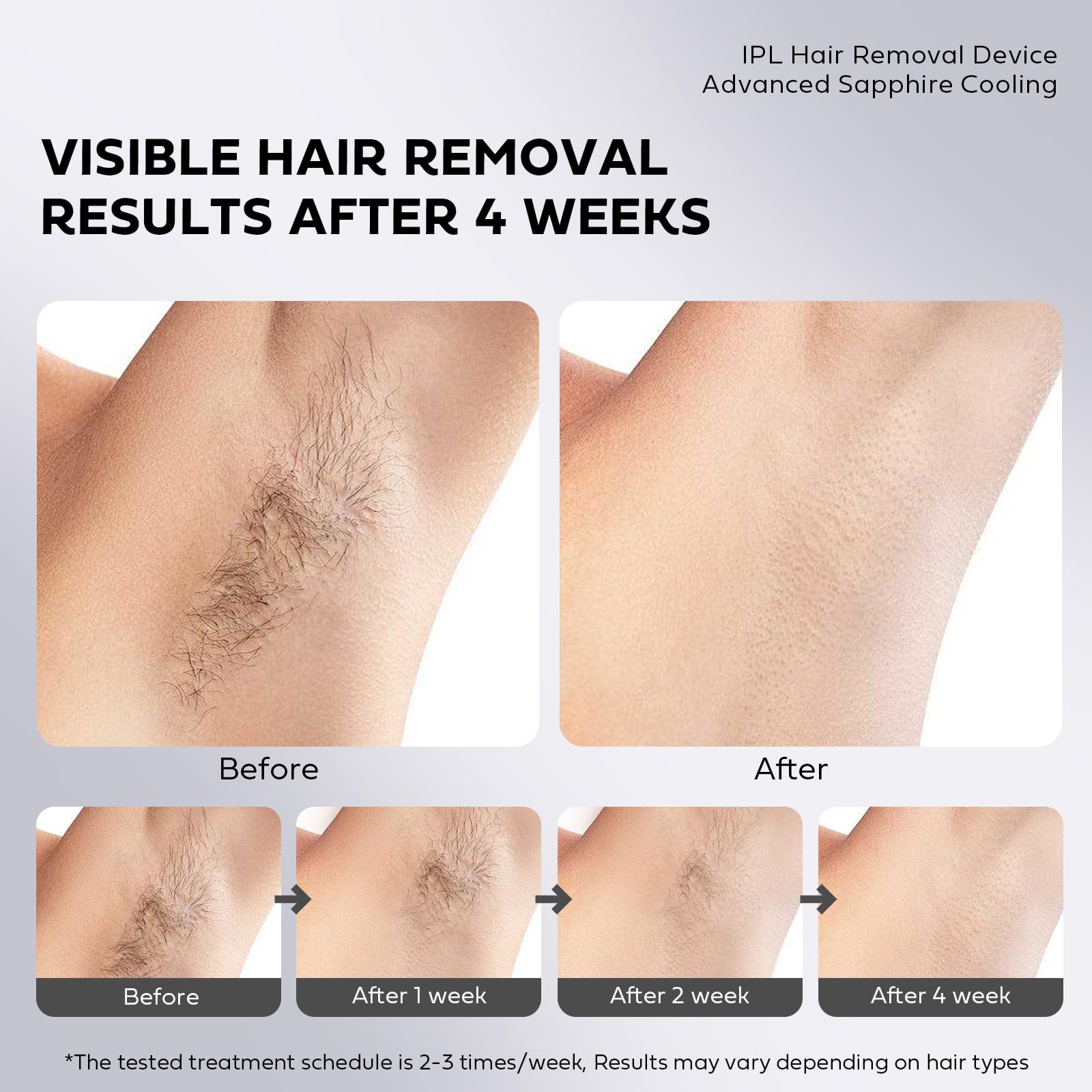 Laser Hair Removal with Ice Cooling, IPL Hair Removal Device Painless, EUARNE Home Use Facial Hair Removal for Women, Dual Lights, Effective in 2 Weeks, Body & Face Epilator, Storage Bag for Travel. - Medaid International