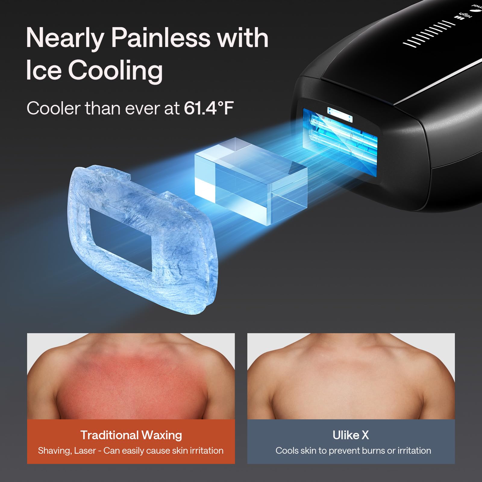 Ulike X IPL Hair Removal Device, Laser Hair Removal with Ice-Cooling, Dual Lights & Skin Senor for Nearly Painless & Long-Lasting Hair Removal, 3 Modes Tailored for Stubborn Hair, Gift for Smooth Skin - Medaid International