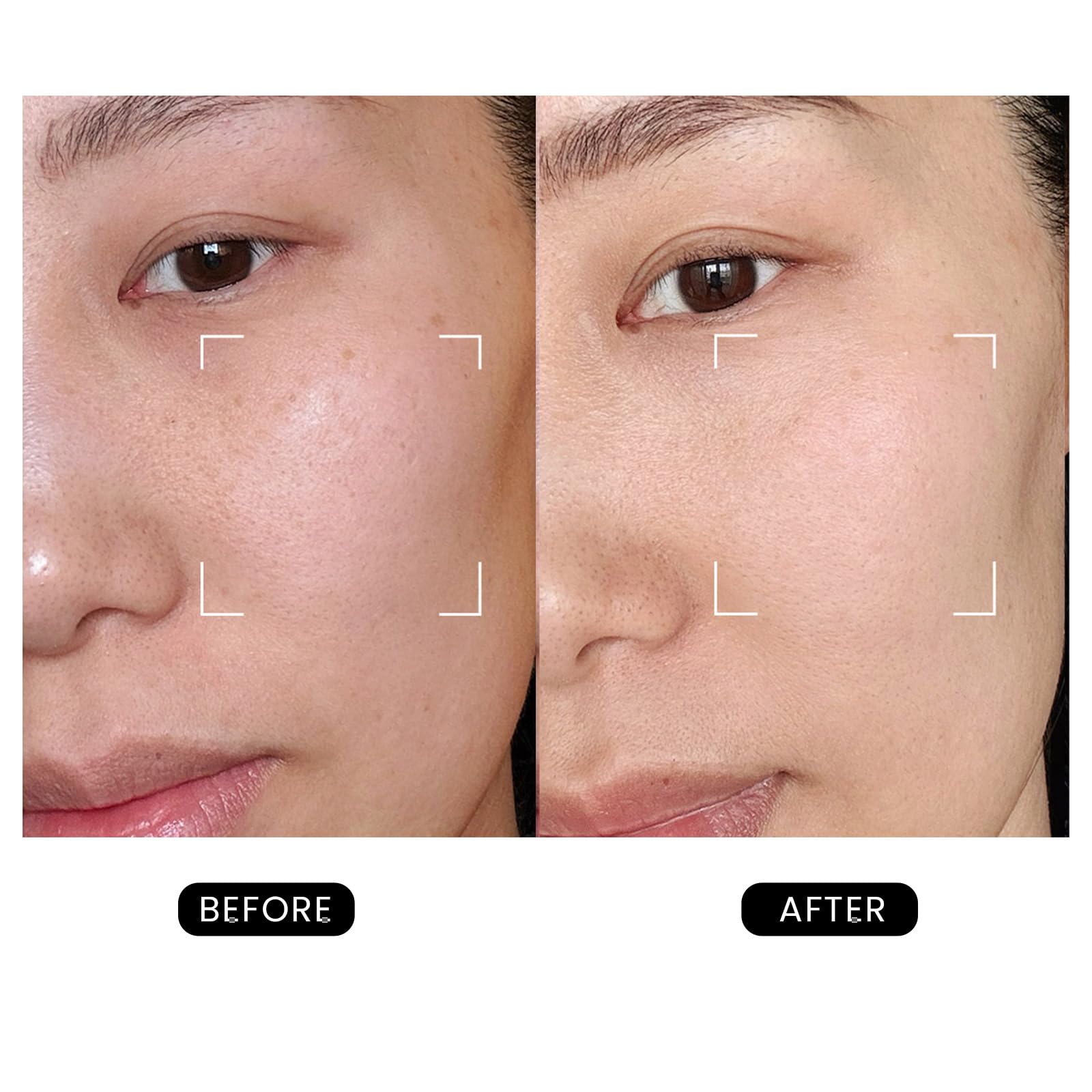 DermRays Revive Skincare for Anti-Aging, Glow Like Never Before,Multifunctional Beauty Device, Facial Massager for Home Use - Medaid International
