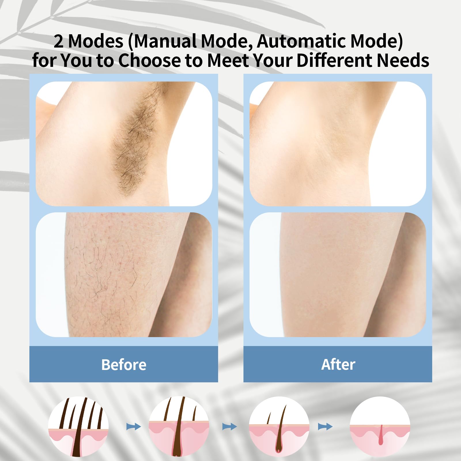 Laser Hair Removal with 9 Energy Levels, 46.4℉ Ice-Cooling Contact IPL Hair Removal for Women, Painless, Effective Hair Removal from Home, for Body & Face - Medaid International