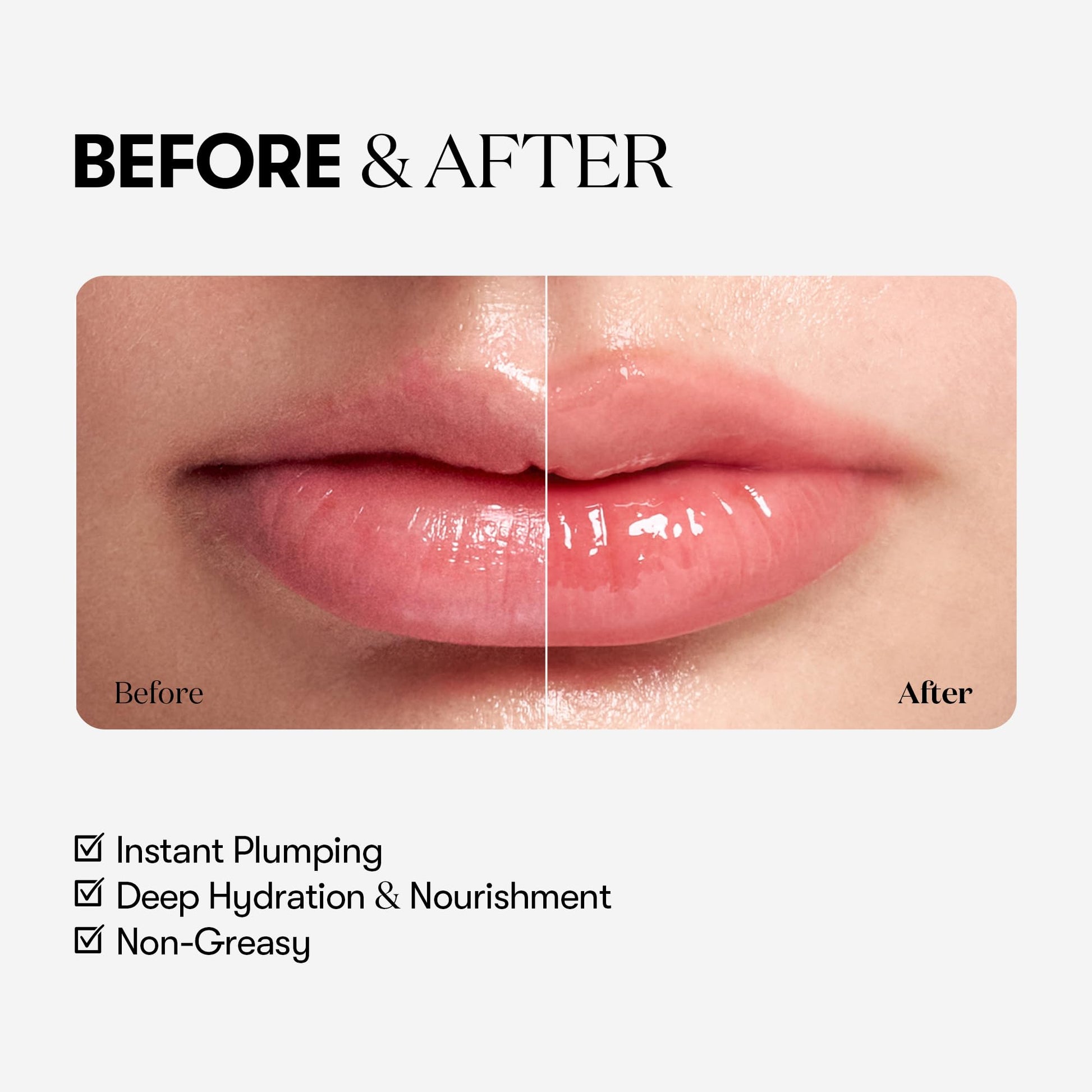 VT COSMETICS Reedle Shot Lip Plumper, Hydrating & Volumizing Clear Lip Gloss, Microneedling Effect & Hyaluronic Acid for Fuller, Smoother Lips, Stocking Stuffers, 0.15 oz (4.3 g) (Beginner) - Medaid International