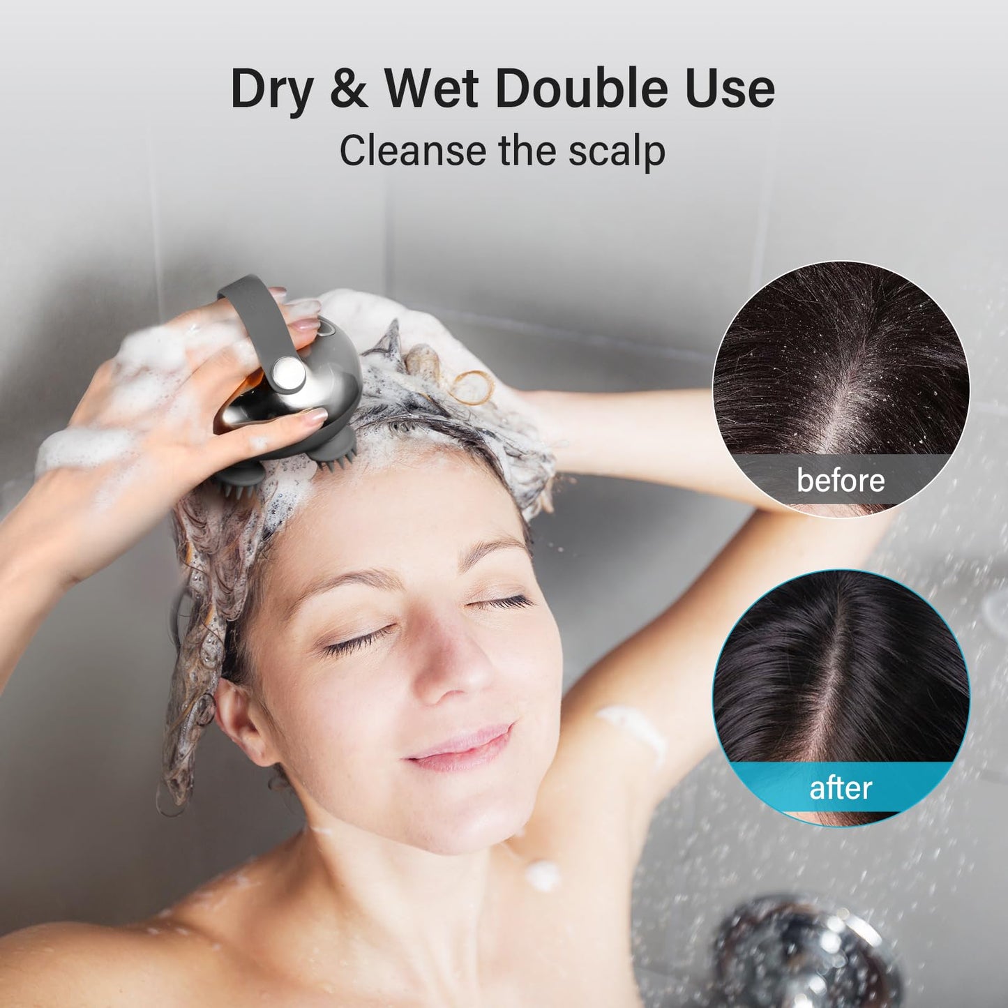 arboleaf Scalp Massager Rechargeable Head Massager Scalp Stress Relax, Waterproof Handheld Hair Scratcher with 8 Removable Massage Claws, Gift for Dad Mom - Medaid International
