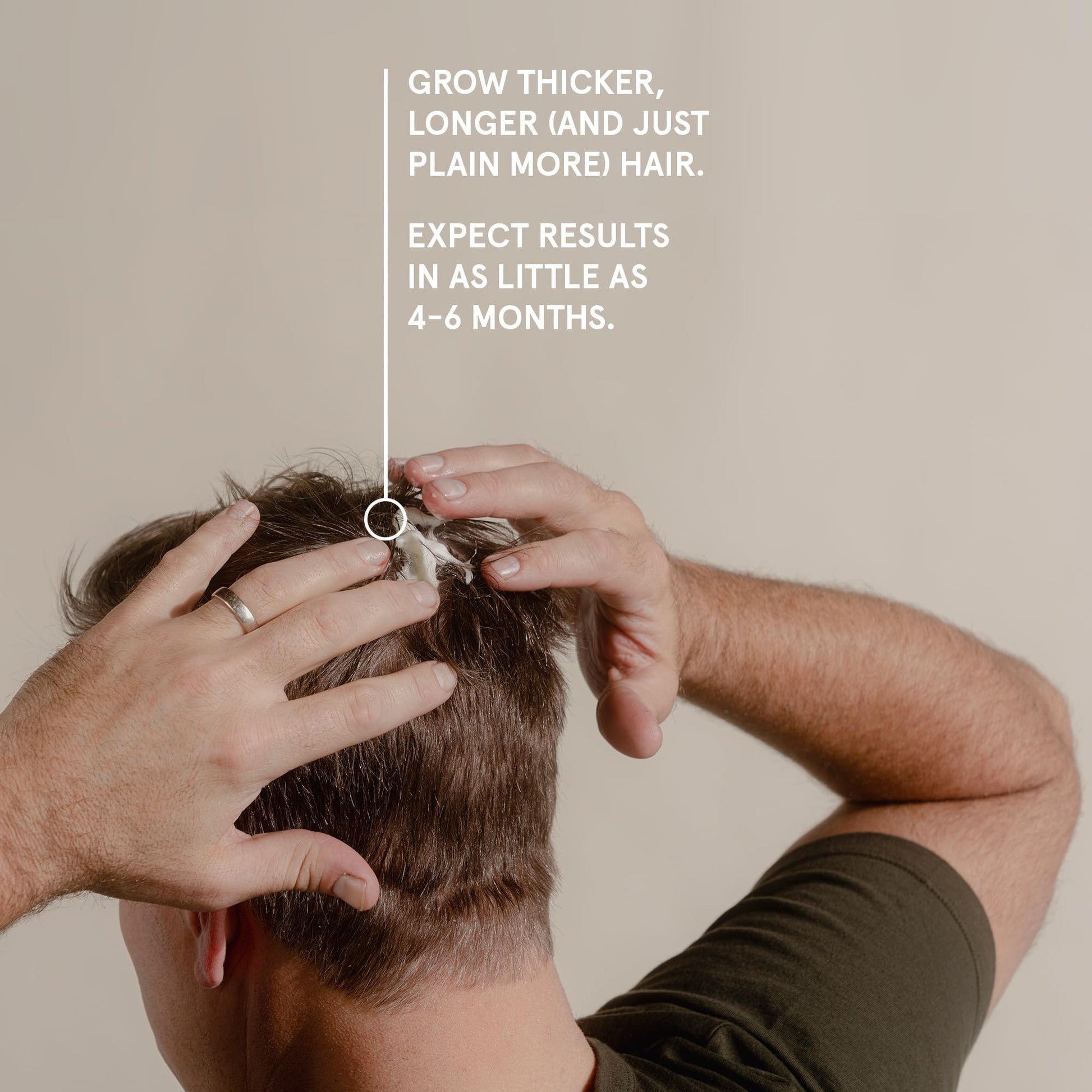 Keeps Extra Strength Minoxidil for Men - 5% Minoxidil Foam Hair Loss & Regrowth Treatment for Thinning & Bald Spots - Clinically Proven Hair Growth Products - Unscented Topical Aerosol Foam - Medaid International
