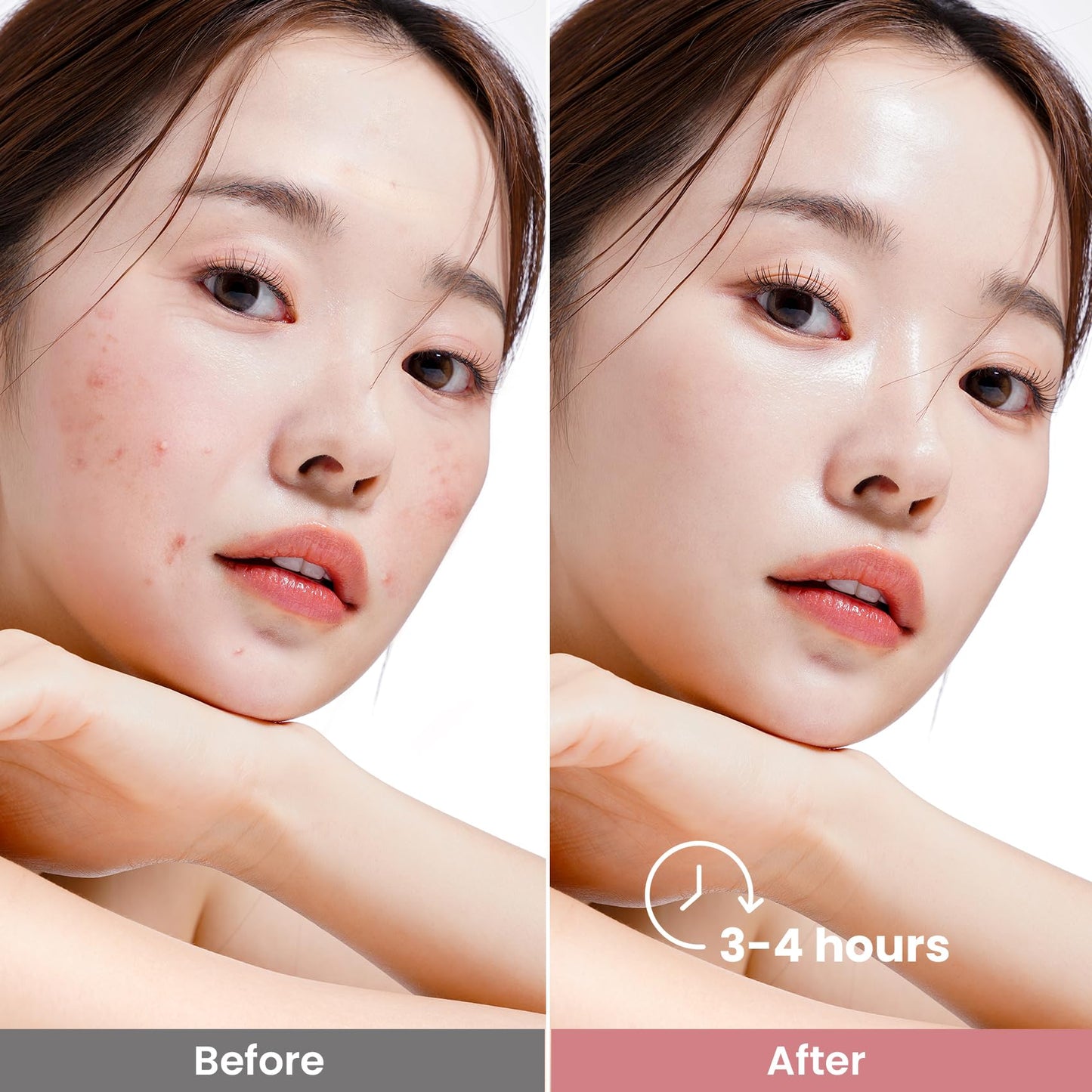 Elvira Bio-Collagen Face Mask - Deep Hydrating Overnight Face Mask, Korean Skincare, Facial Treatments & Masks for Women - Firming and Moisturizing, 4-Pack - Medaid International