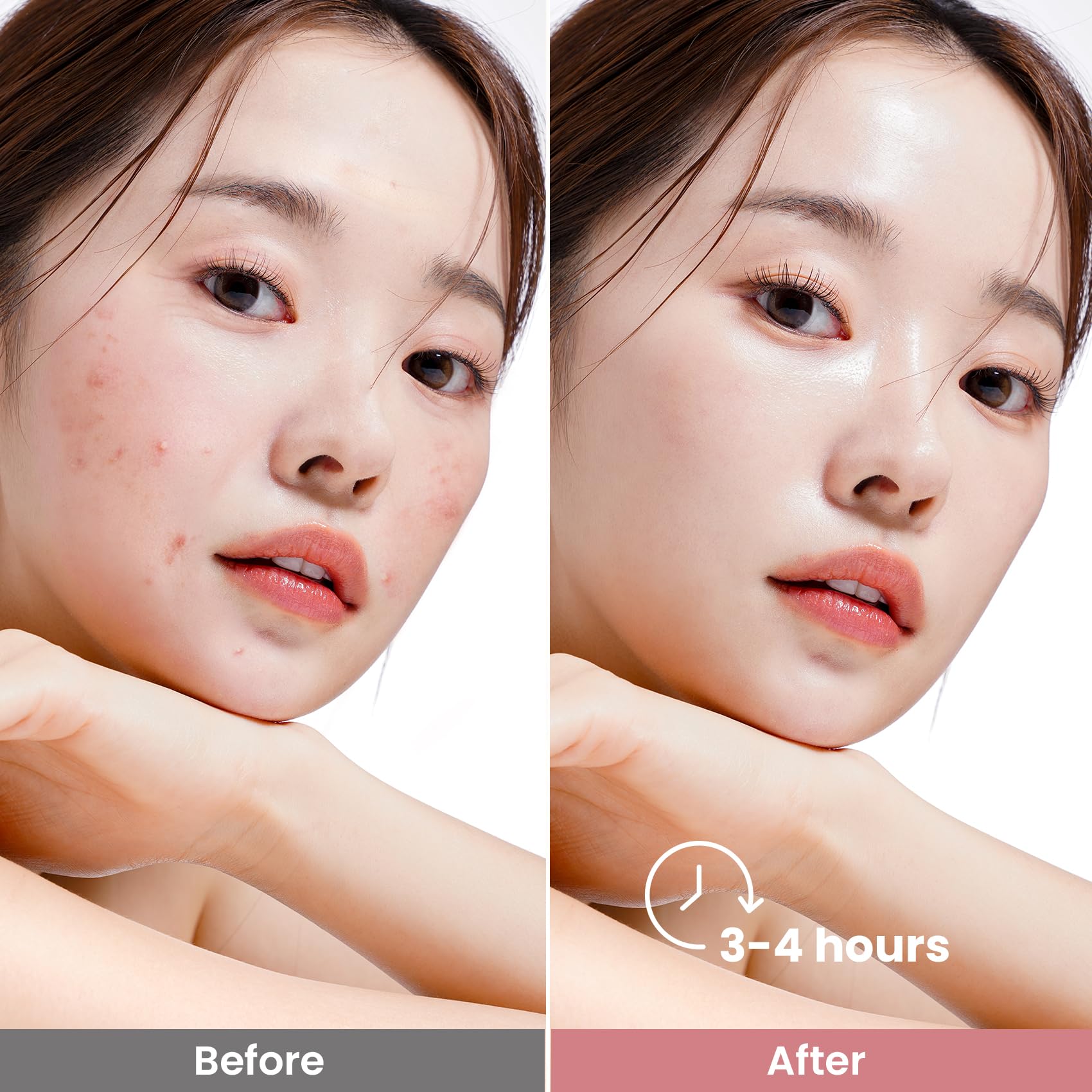 Elvira Bio-Collagen Face Mask - Deep Hydrating Overnight Face Mask, Korean Skincare, Facial Treatments & Masks for Women - Firming and Moisturizing, 4-Pack - Medaid International