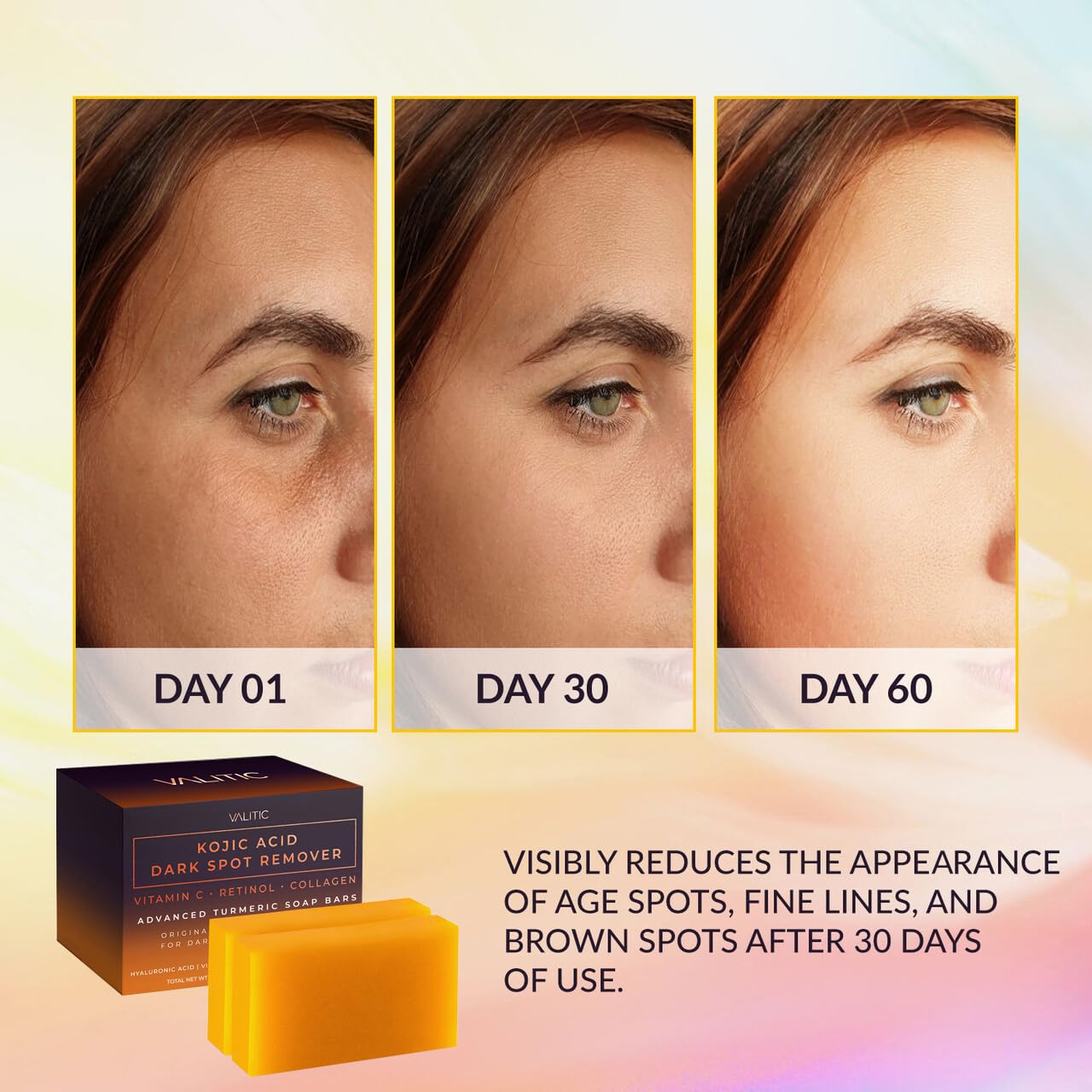 VALITIC Kojic Acid Dark Spot Remover Soap Bars with Vitamin C, Retinol, Collagen, Turmeric - Original Japanese Complex Infused with Hyaluronic Acid, Vitamin E, Shea Butter, Castile Olive Oil (2 Pack) - Medaid International