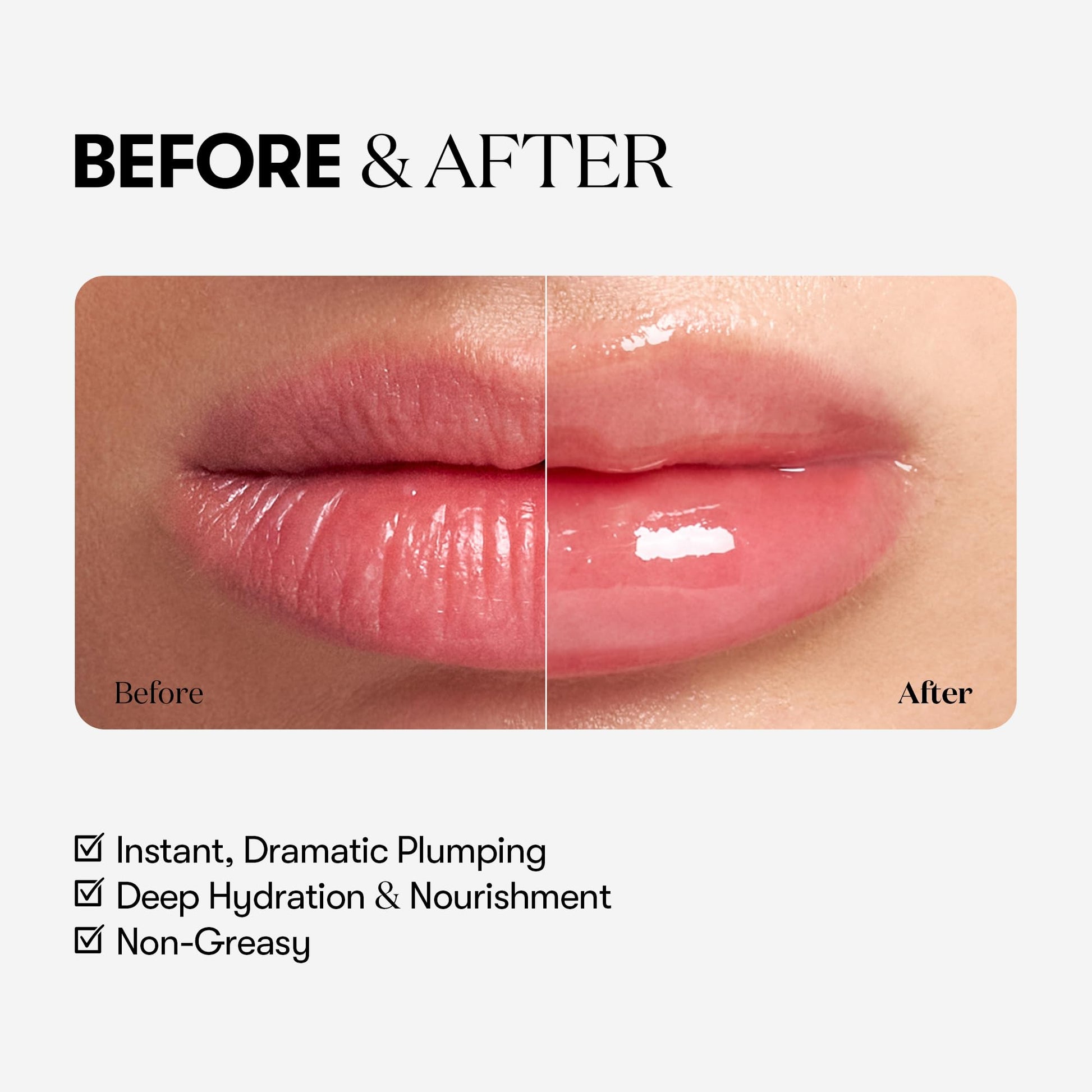 VTCOSMETICS Reedle Shot Lip Plumper, 0.15 oz (4.3 g), Moisturizing, Transparent, Lip Gloss, Stocking Stuffers, Fragrance-free, Korean Cosmetics (Expert) - Medaid International