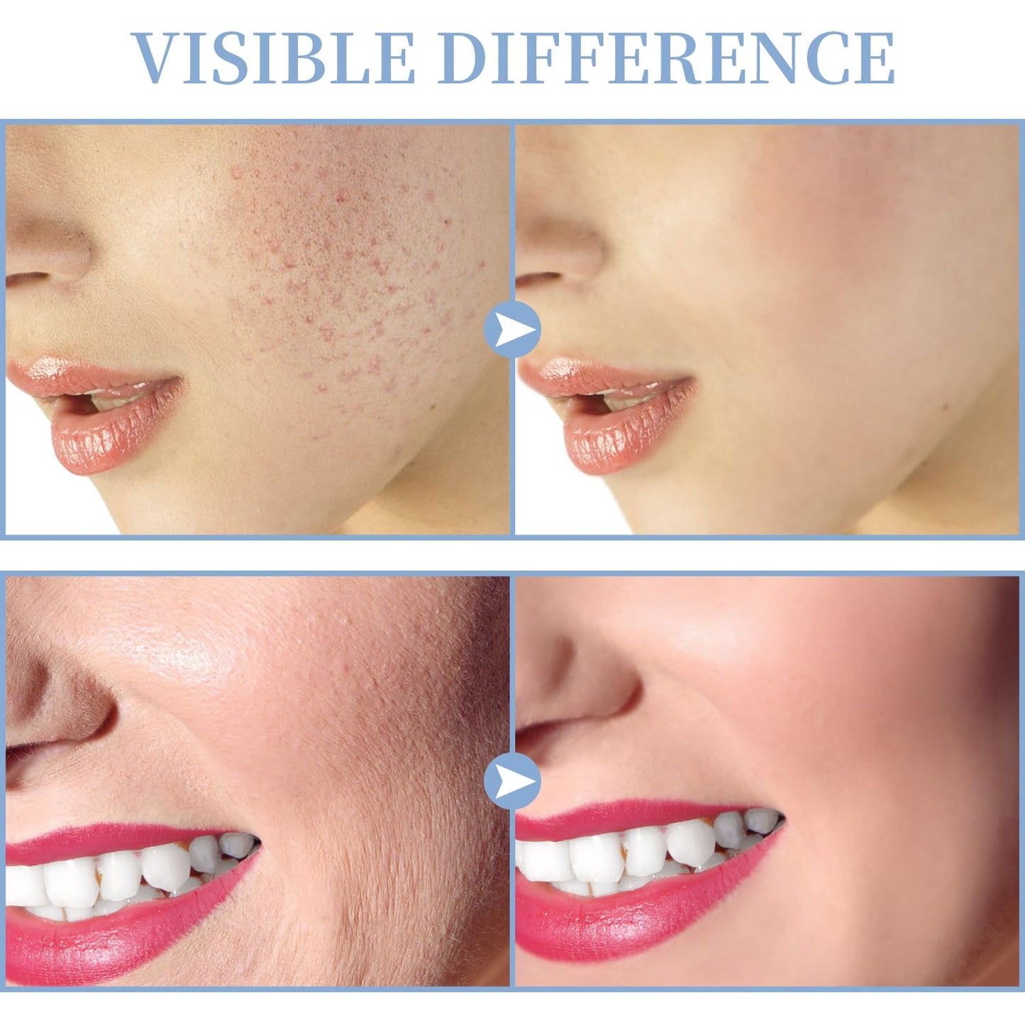 High Frequency Facial Machine - TUMAKOU Portable Handheld High Frequency Facial Skin Wand Machine with 4 Different Tubes - Medaid International