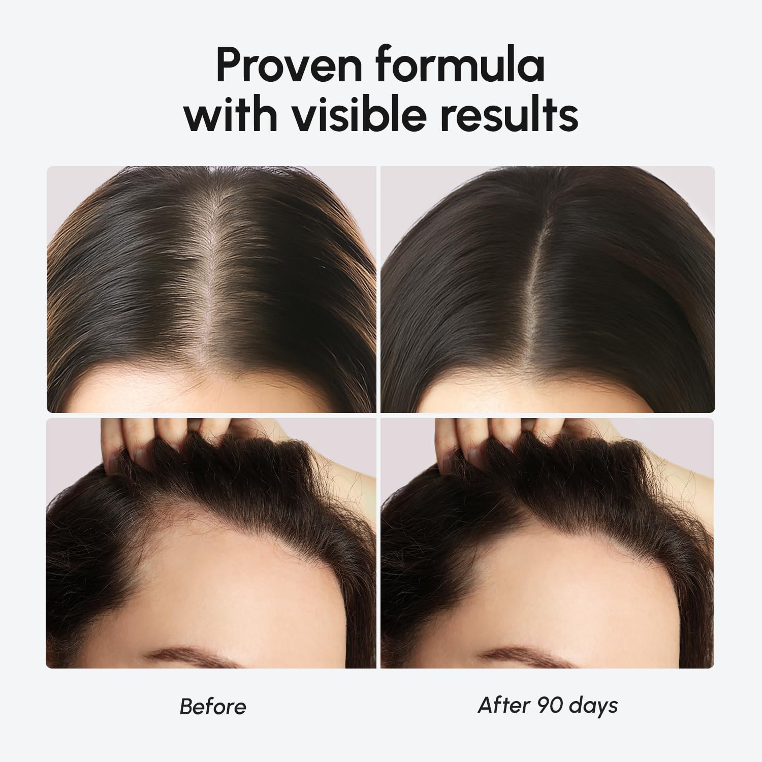 MAREE Hair Growth Serum - Caffeine Peptides Castor Rosemary Oil for Hair Growth - Products for Women & Men - Hair Oils for Hair Growth - Hair Regrowth Tonic - Scalp Serum - Suero Para El Cabello - Medaid International