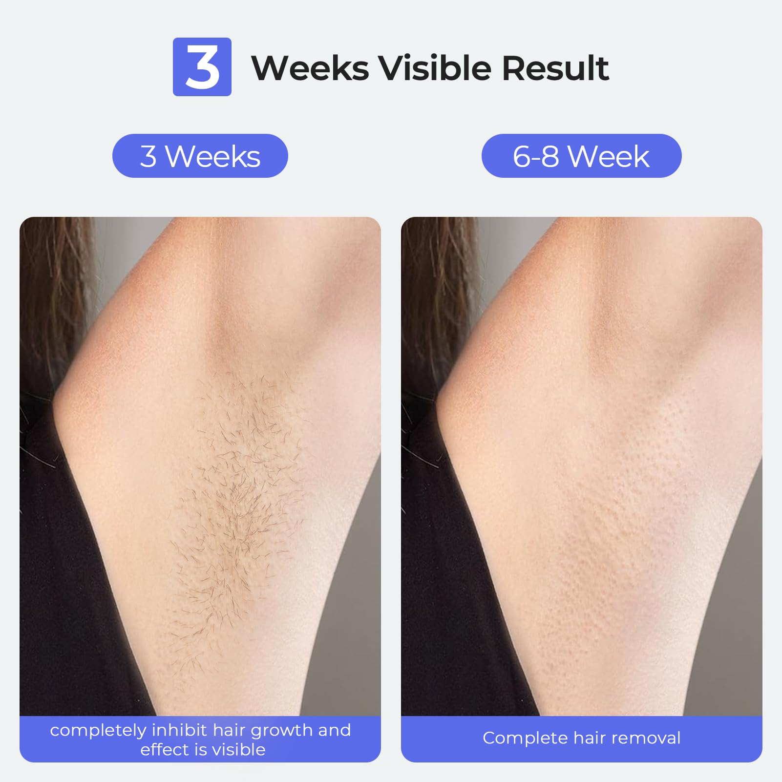 LUBEX Painless Sapphire Ice Cooling IPL Laser Hair Removal Device at Home for Women & Men, 1,000,000+ Unlimited Flashes, Safe and Permanent, Alternative to Salon Hair Removal for Face, Body, Bikini - Medaid International