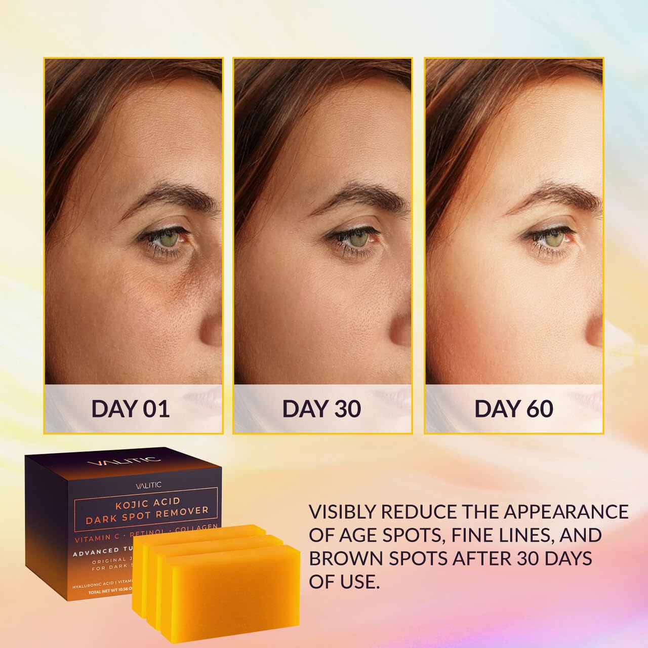 VALITIC Kojic Acid Dark Spot Remover Soap Bars with Vitamin C, Retinol, Collagen, Turmeric - Original Japanese Complex Infused with Hyaluronic Acid, Vitamin E, Shea Butter, Castile Olive Oil (3 Pack) - Medaid International
