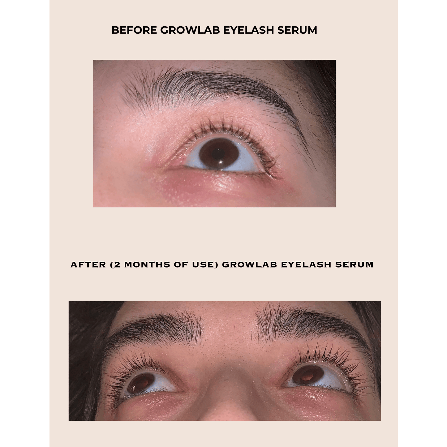 GROWLAB Eyelash Serum - Medaid International