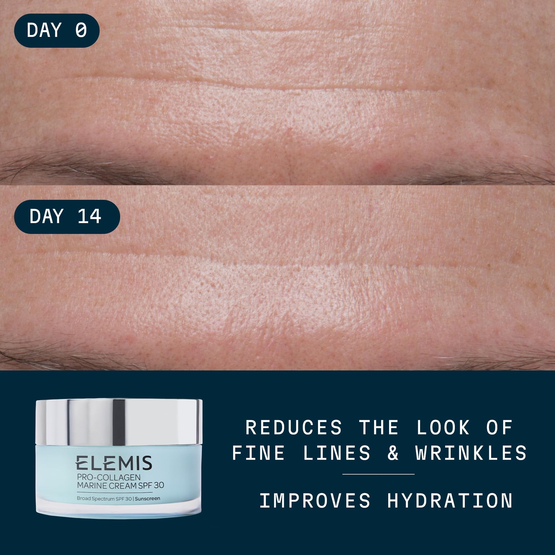 ELEMIS Pro-Collagen Marine Cream SPF 30, Lightweight Anti-Wrinkle Daily Facial Moisturizer - Medaid International