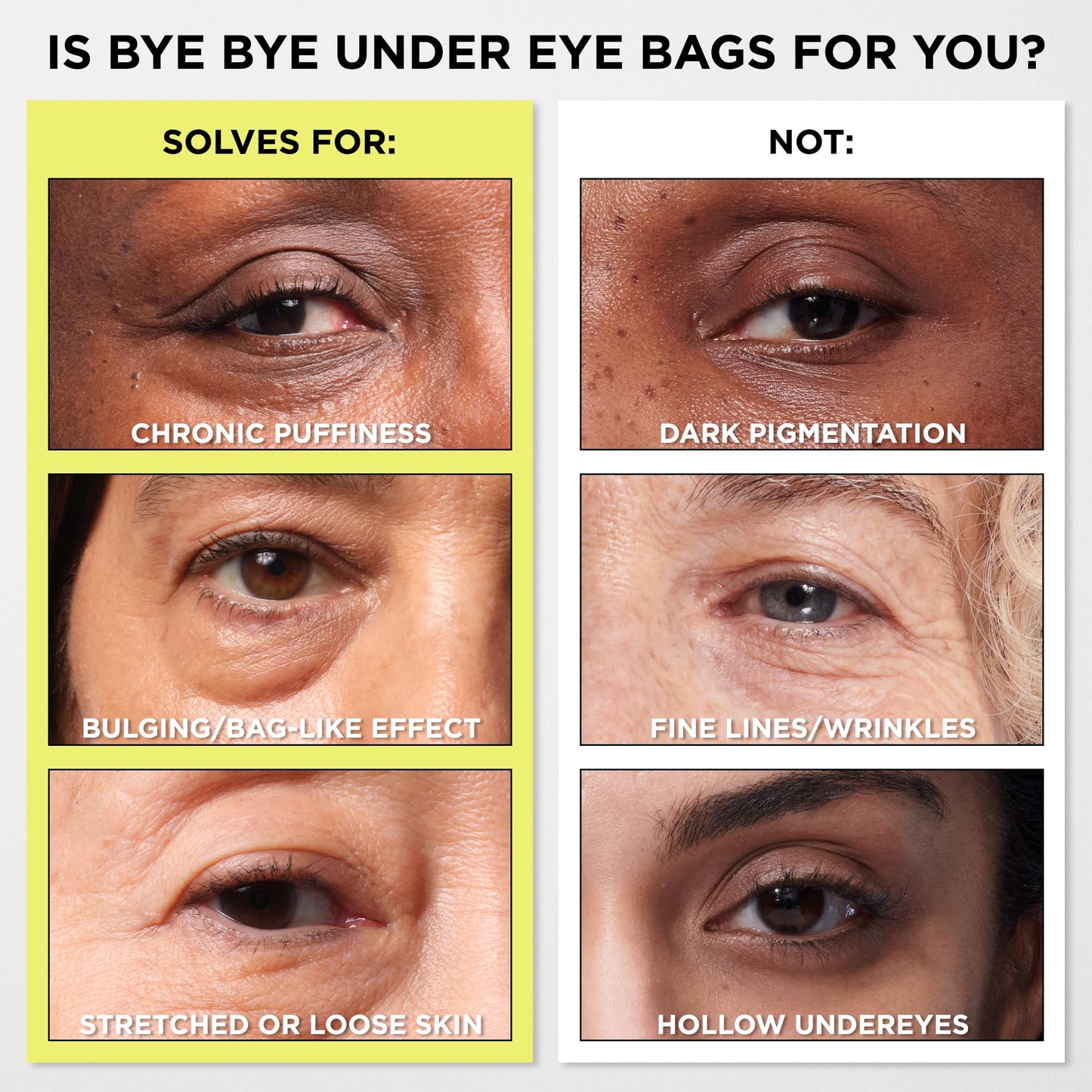 IT Cosmetics Bye Bye Under Eye Bags Treatment For Women & Men – Temporary Eye Bag Reducer & Undereye Corrector Depuffs, Tightens, Smooths & Reduces Look of Wrinkles & Fine Lines - 0.5 Fl. Oz - Medaid International