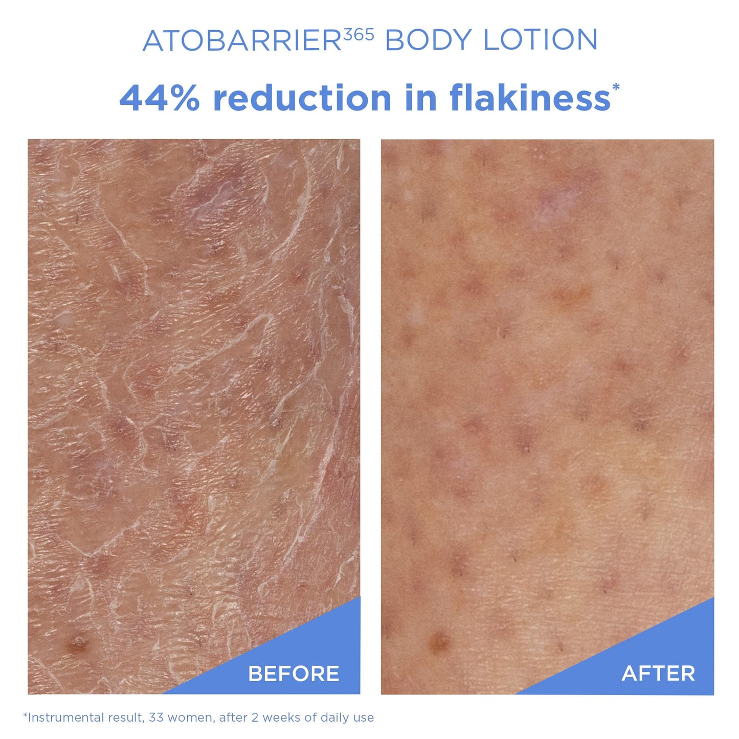 AESTURA ATOBARRIER365 Cream + Body Lotion - Medaid International