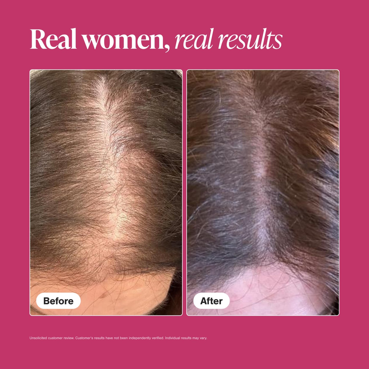 Viviscal Hair Growth Supplements for Women, Thicker Fuller Hair Support for Thinning Hair and Hair Loss, with Biotin and Marine Collagen, Drug-Free, 180 Tablets, 90-Day Supply - Medaid International