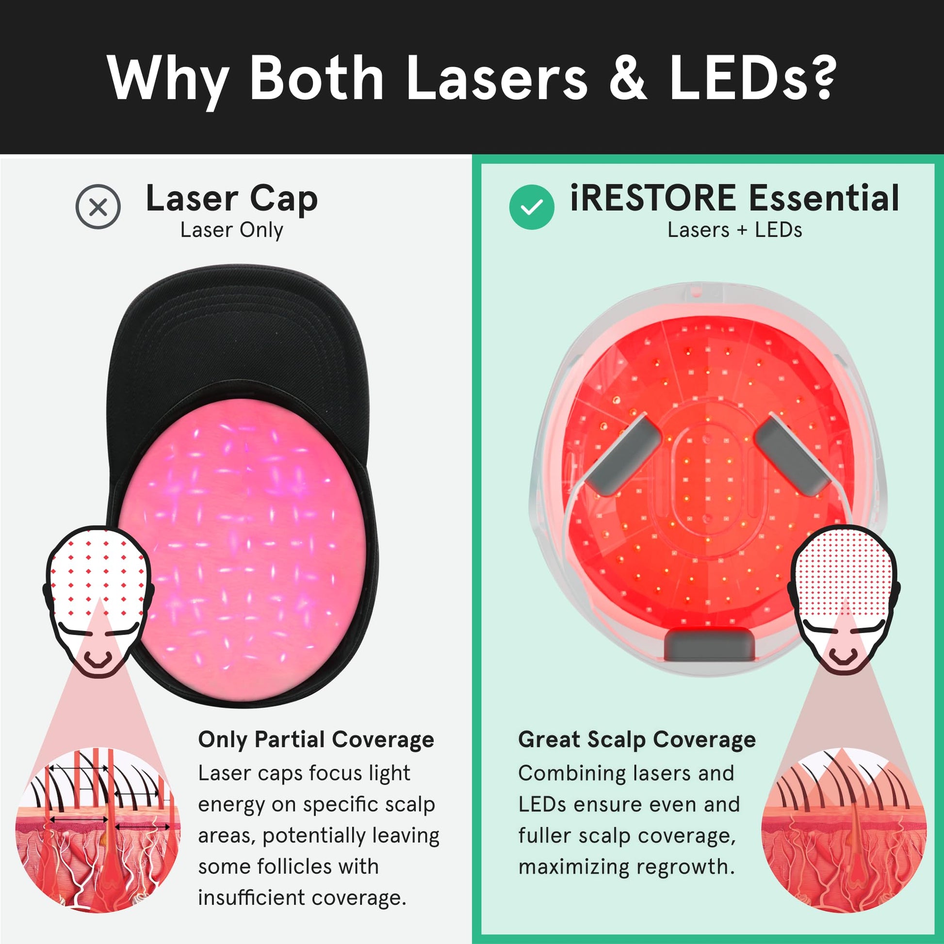 iRestore Essential - Laser Red Light Therapy for Hair Growth - FDA Cleared Hair Loss, Hair Thinning & Alopecia Treatment for Men & Women - Laser Cap for Hair Regrowth Stimulate Denser Fuller Hair - Medaid International