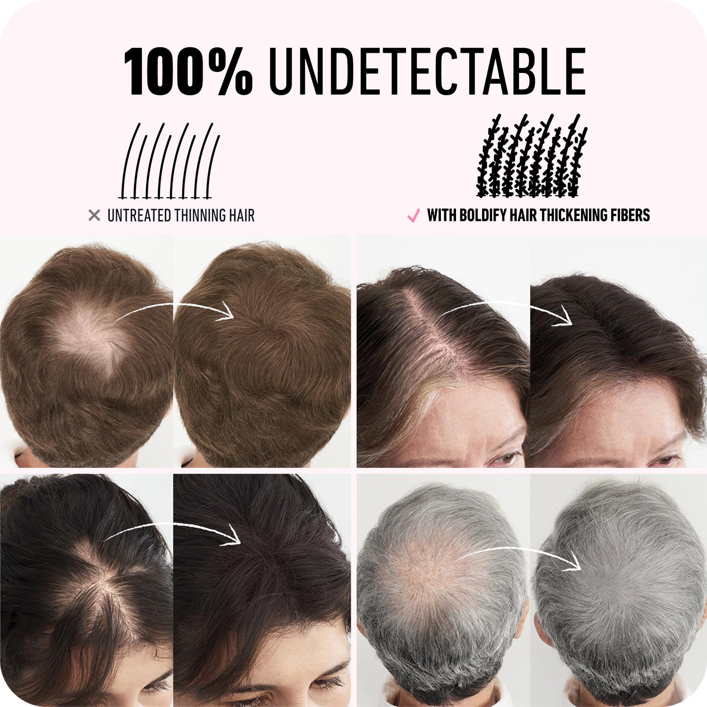 BOLDIFY Hair Fibers (56g) - Fill In Thinning and Fine Hair for an Instantly Fuller, Thicker Look - 14 Shades for Women & Men - Dark Brown - Medaid International