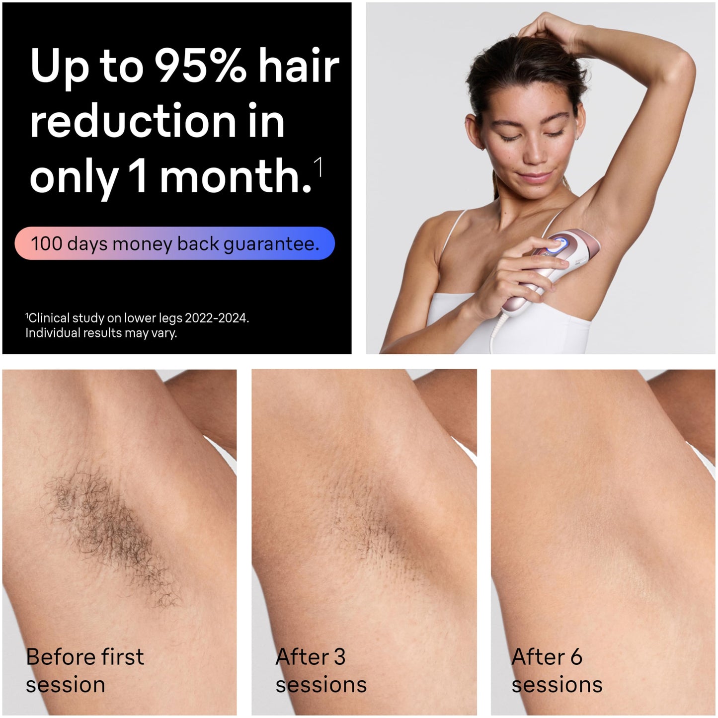 Braun Smart IPL, Skin i·Expert Pro 7: at Home Laser Hair Removal, Permanent Visible Hair Reduction, Holiday Gifts for Women and Men with Free App, Vanity Case, Venus Razor, 3 Smart Heads, IPL7243 - Medaid International