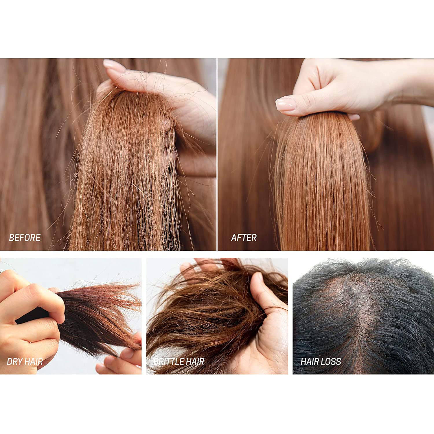 Luv Me Care Biotin Hair Growth Oil Hair Growth Serum for Thicker Longer Fuller Healthier Hair, Prevent Hair Loss & Thinning, All Natural Vitamin Rich Treatment, Women & Men, All Hair Types 1.7 oz - Medaid International