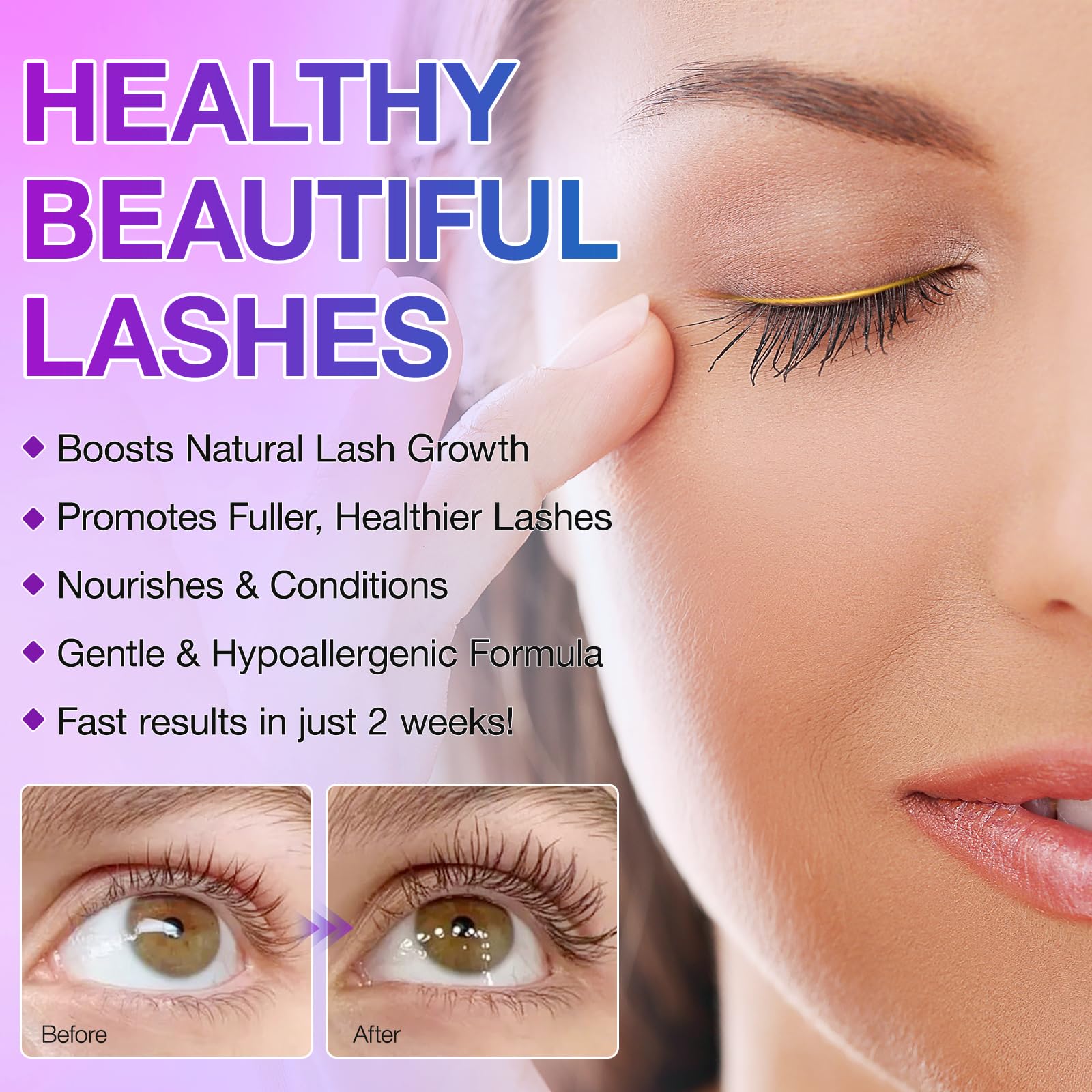 Advanced Eyelash Growth Serum for Longer, Fuller and Thicker Lashes in a Month - Women's Lash Enhancer (5ml) - Medaid International