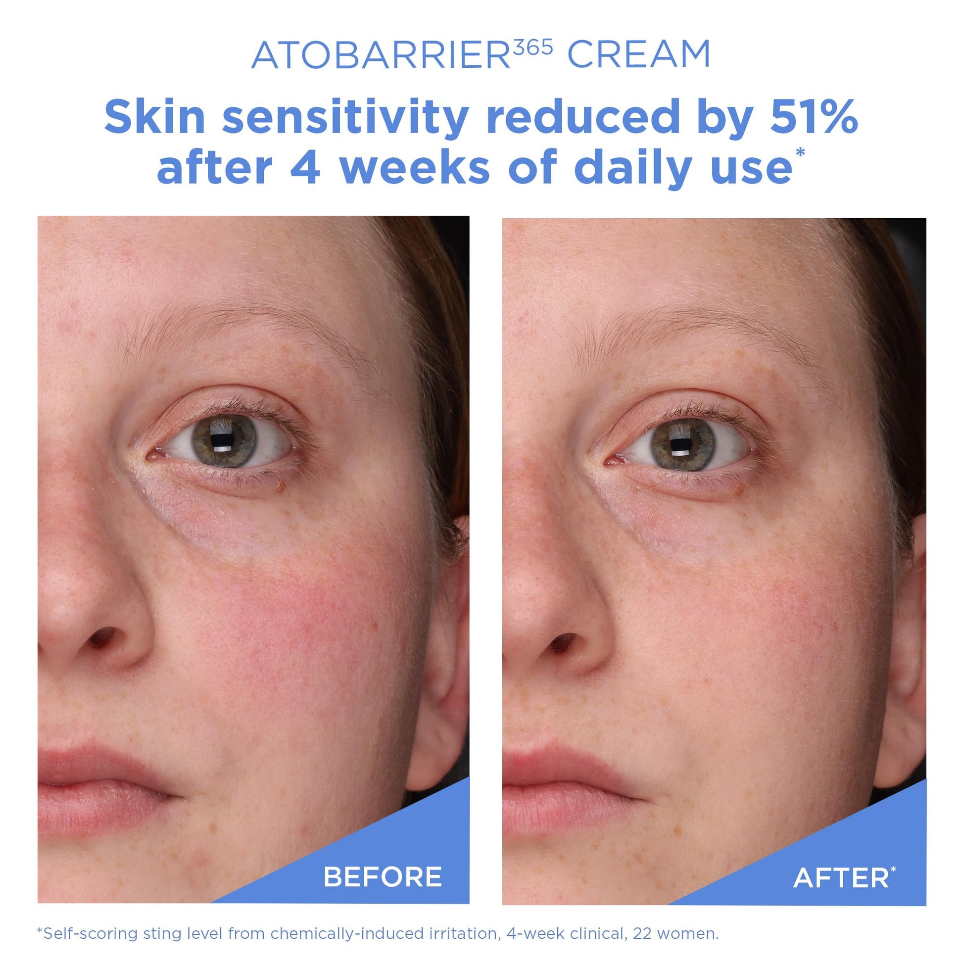 AESTURA ATOBARRIER365 Cream with Ceramides, Korean Face Moisturizer for Barrier Repair | 120H lasting Hydration, Ceramide Capsules, Dry & Sensitive Skin, Non-comedogenic, 80 mL / 2.70 fl.oz. - Medaid International