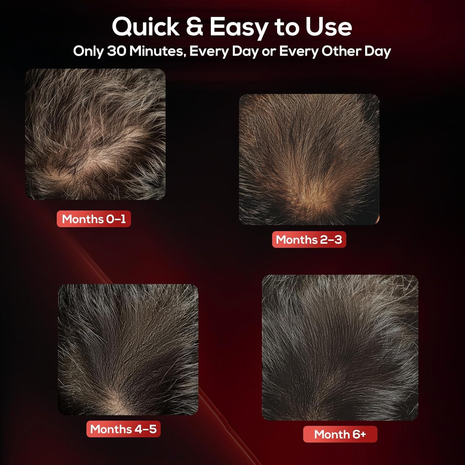 Laser Hair Growth Cap, Low Level Laser Therapy (LLLT) Device Designed to Promote Hair Growth in Women and Men,Laser Cap - Medaid International