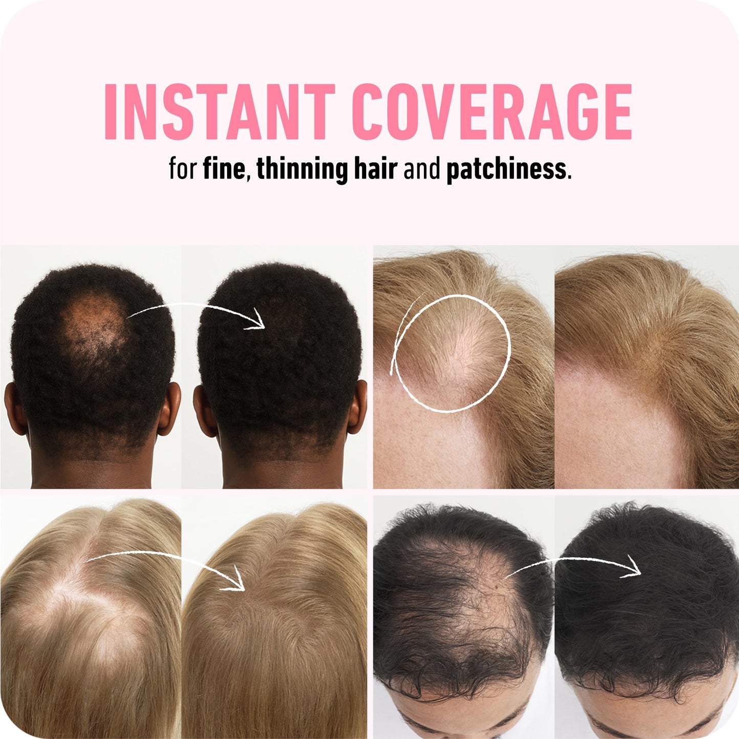 BOLDIFY Hair Fibers (56g) - Fill In Thinning and Fine Hair for an Instantly Fuller, Thicker Look - 14 Shades for Women & Men - Dark Brown - Medaid International