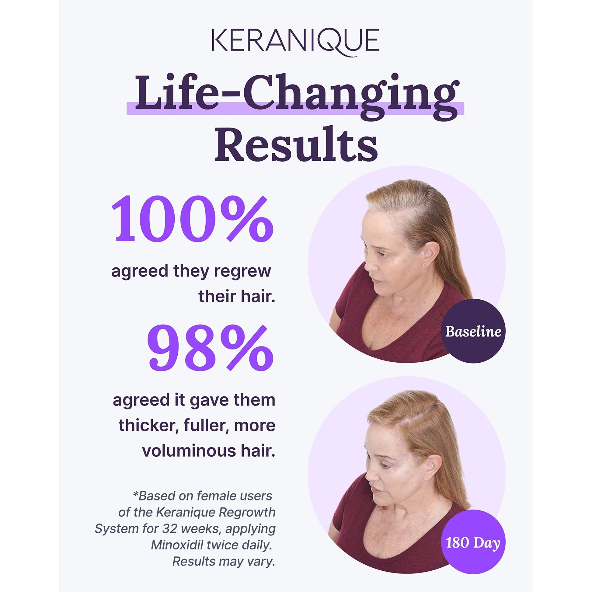 Keranique Hair Regrowth Treatment for Women - 2% Minoxidil for Hair Growth & Thickening - Topical Solution Scalp Treatment for Hair Loss & Thinning w/ Precision Spray Applicator - 2 Fl Oz - Medaid International