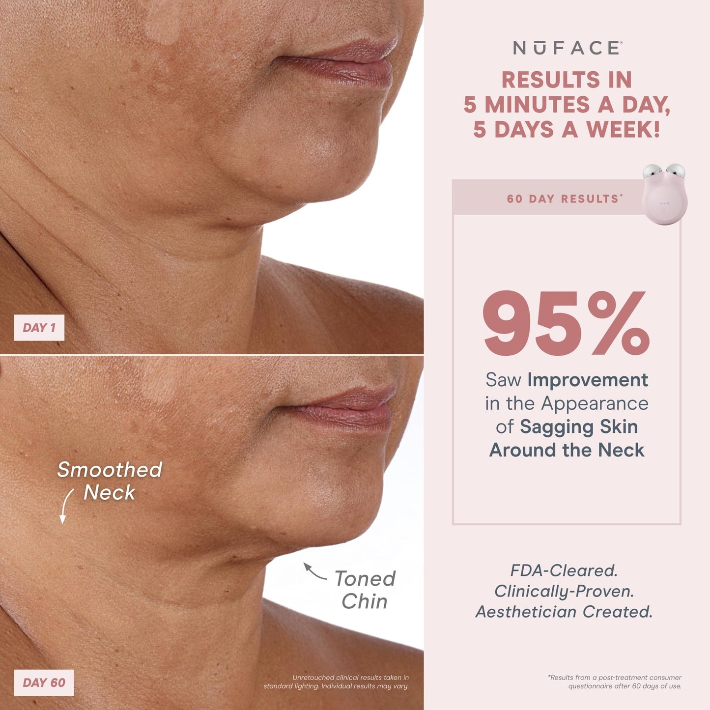 NuFACE MINI+ Microcurrent Facial Device Kit - Limited Edition FDA Cleared Face Massager Device + Microcurrent Gel Activator & Applicator Brush - Velvet Rose - Medaid International