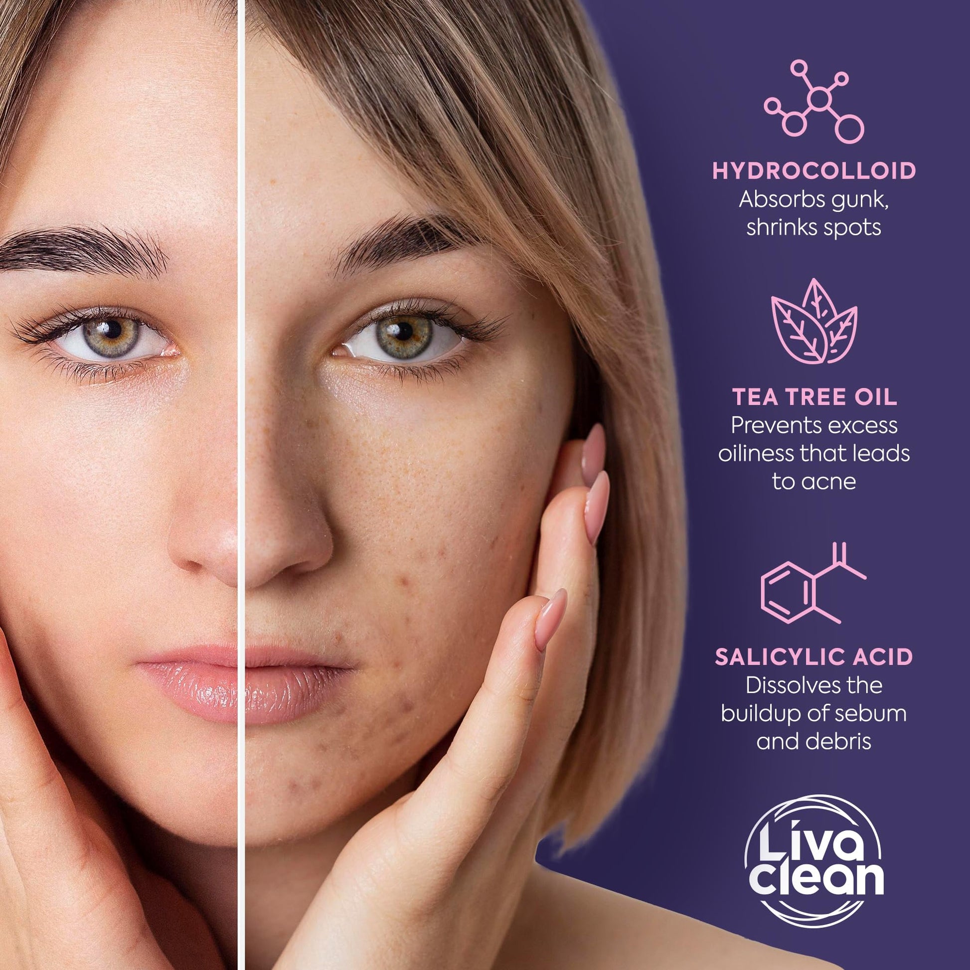 Livaclean Star Pimple Patches for Face w/ Hydrocolloid, Tea Tree oil & Salicylic Acid - Zit Stickers, Hydrocolloid Acne Patches for Face - Cute Pimple Patch, Acne Stickers - Medaid International