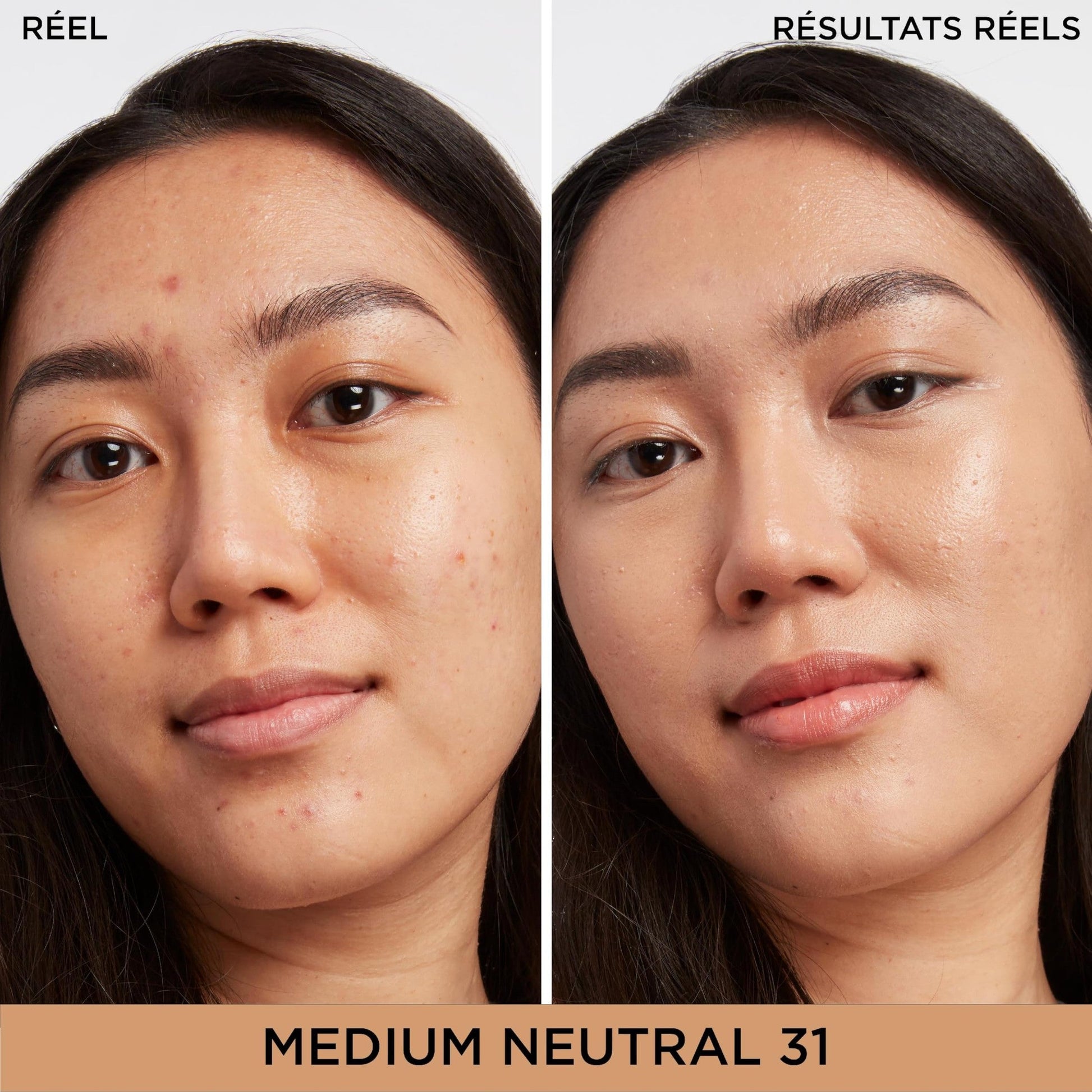 IT Cosmetics Bye Bye Dark Spots Concealer + Brightening Serum – 2% Niacinamide, Hyaluronic Acid & Caffeine - Medium Coverage, Natural Finish, All Skin Types – 31 Medium Neutral, 0.22 fl. oz - Medaid International
