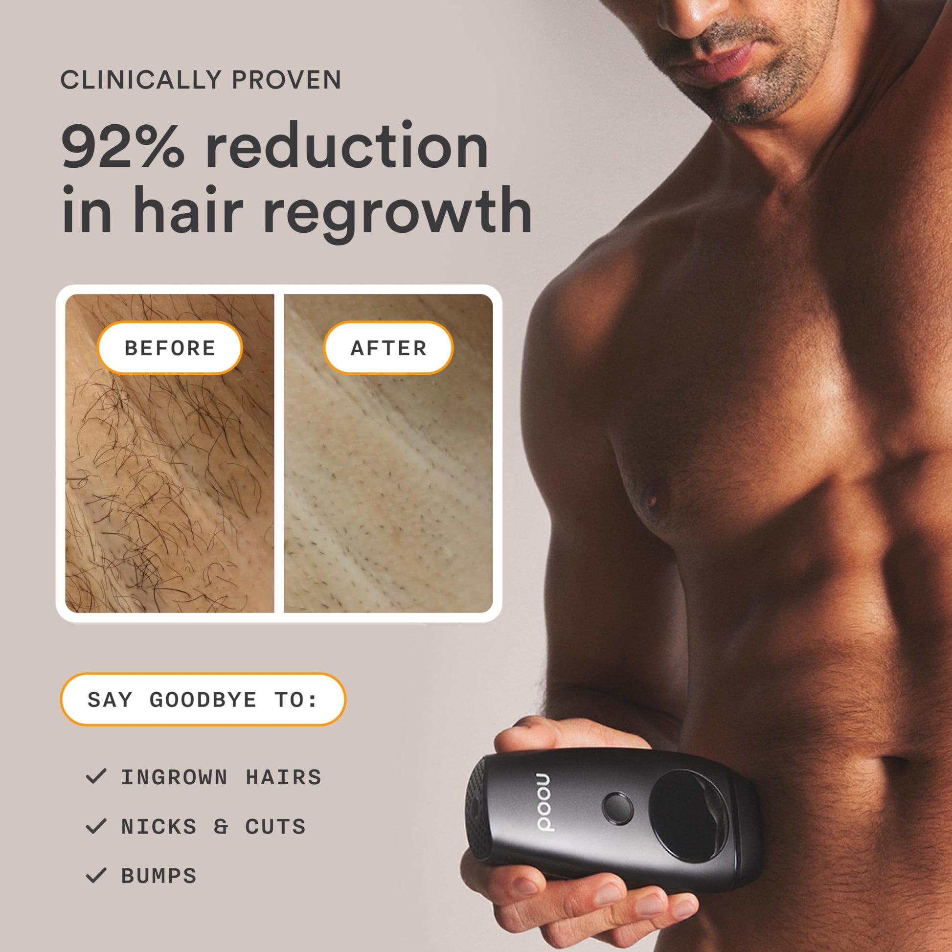 NEW Nood™ Flasher 2.0 + Serum — IPL Laser Hair Removal Device for Women & Men with After Shave to Treat & Prevent Ingrown Hairs, Bumps Slowing Hair Regrowth — Pain-Free IPL Hair Removal — Gloss White - Medaid International