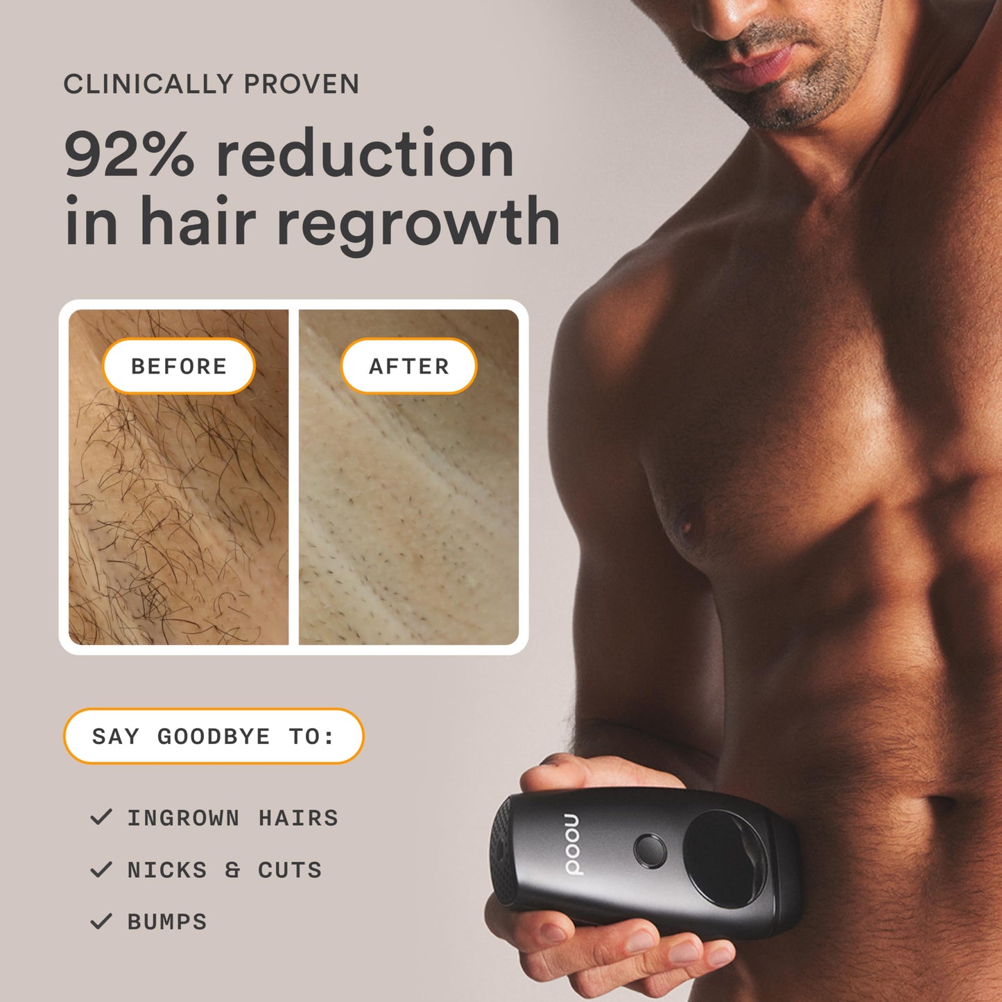 NEW Nood™ Flasher 2.0 + Shaving Starter Kit — IPL Laser Hair Removal Device for Women & Men with Refillable 5-Blade Razors — Pain-Free IPL Hair Removal Works Wherever Hair Grows — Matte Black - Medaid International