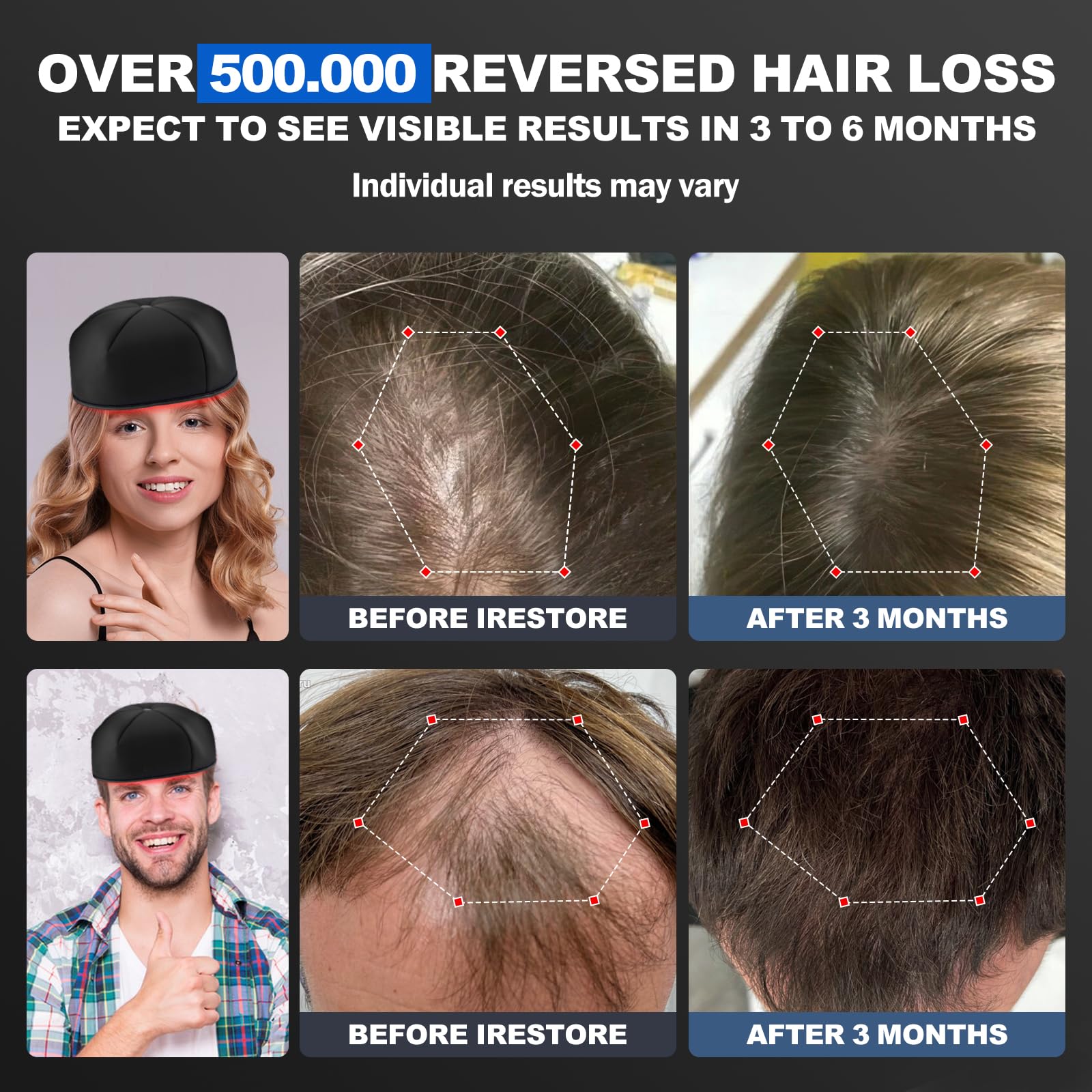 Laser Cap, FDA Cleared Laser Hair Growth Cap, Red Light Therapy promote hair growth in women and men - Medaid International