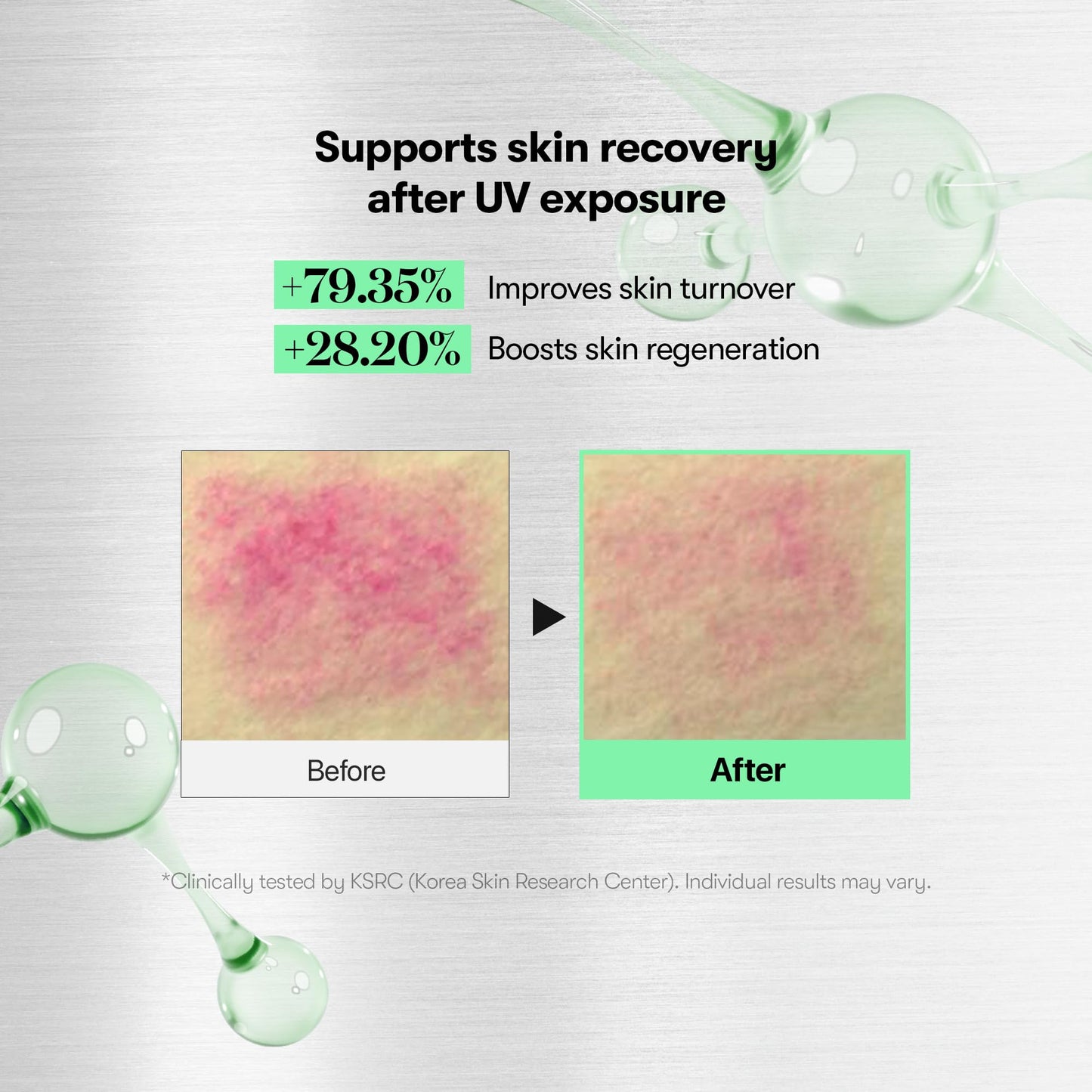 VT COSMETICS CICA Reedle Shot 700, Spicule Microneedling Serum for Pore Care&Exfoliation, Exosome&Centella Asiatica for Glass Skin, Acne&Blemish Care, Korean Liquid Skin Booster (1 Fl Oz / 30ml) - Medaid International