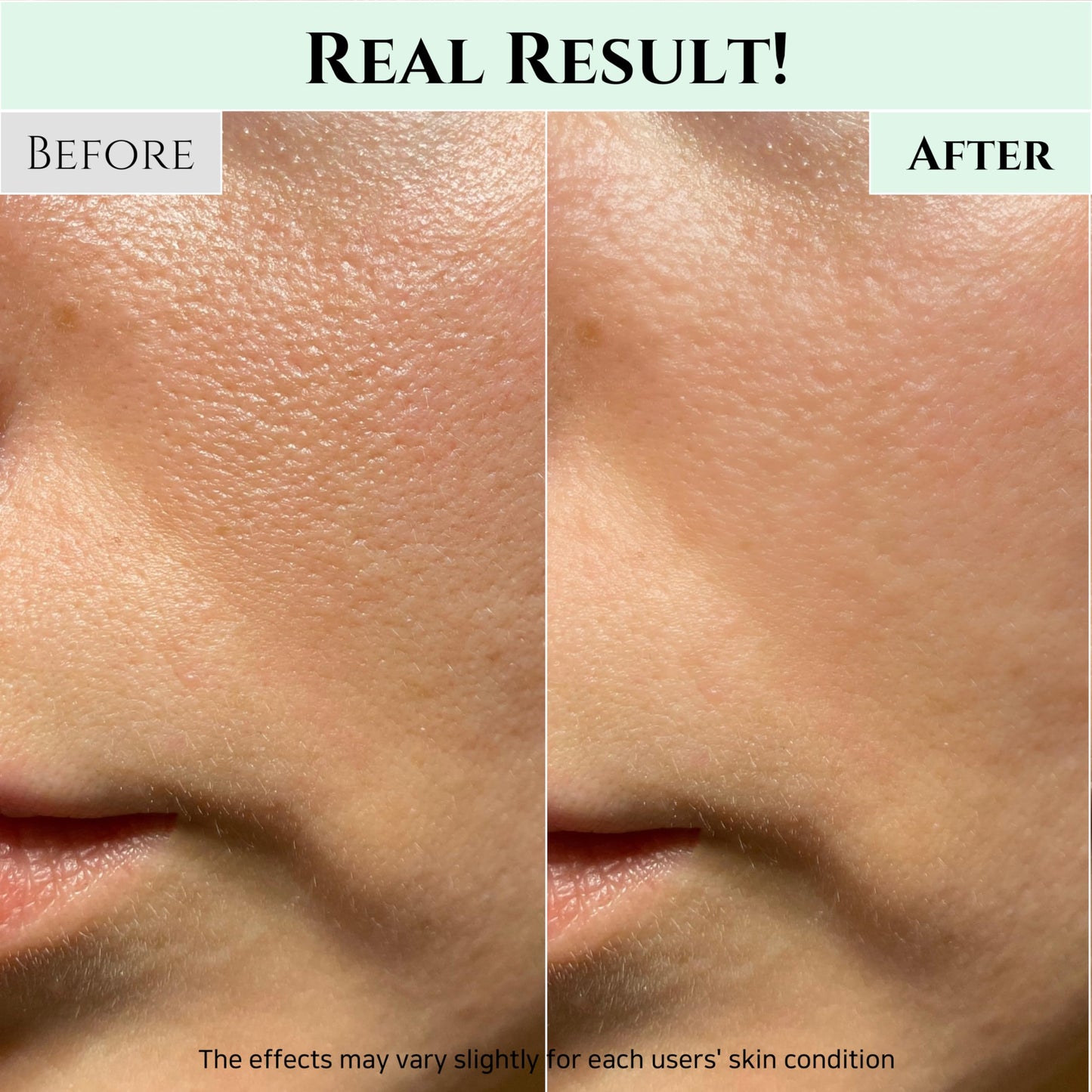 Beauty of Joseon Apricot Blossom Peeling Gel Soft Exfoliating Face with Green Plum Refreshing Cleanser Gel Type Deep Pore Cleansing - Medaid International