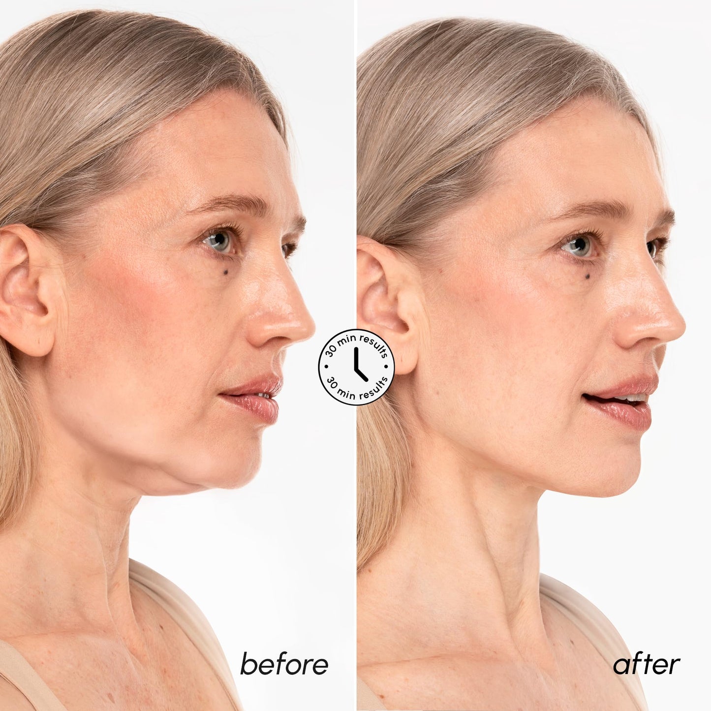 MAREE V Line Lifting Mask with 24K Gold – Deep Collagen Face Mask for Women – Jawline Shaper Mask with Retinol & Hyaluronic Acid – Neck Tightening & Firming - Double Chin Strap for Face Lift - Medaid International