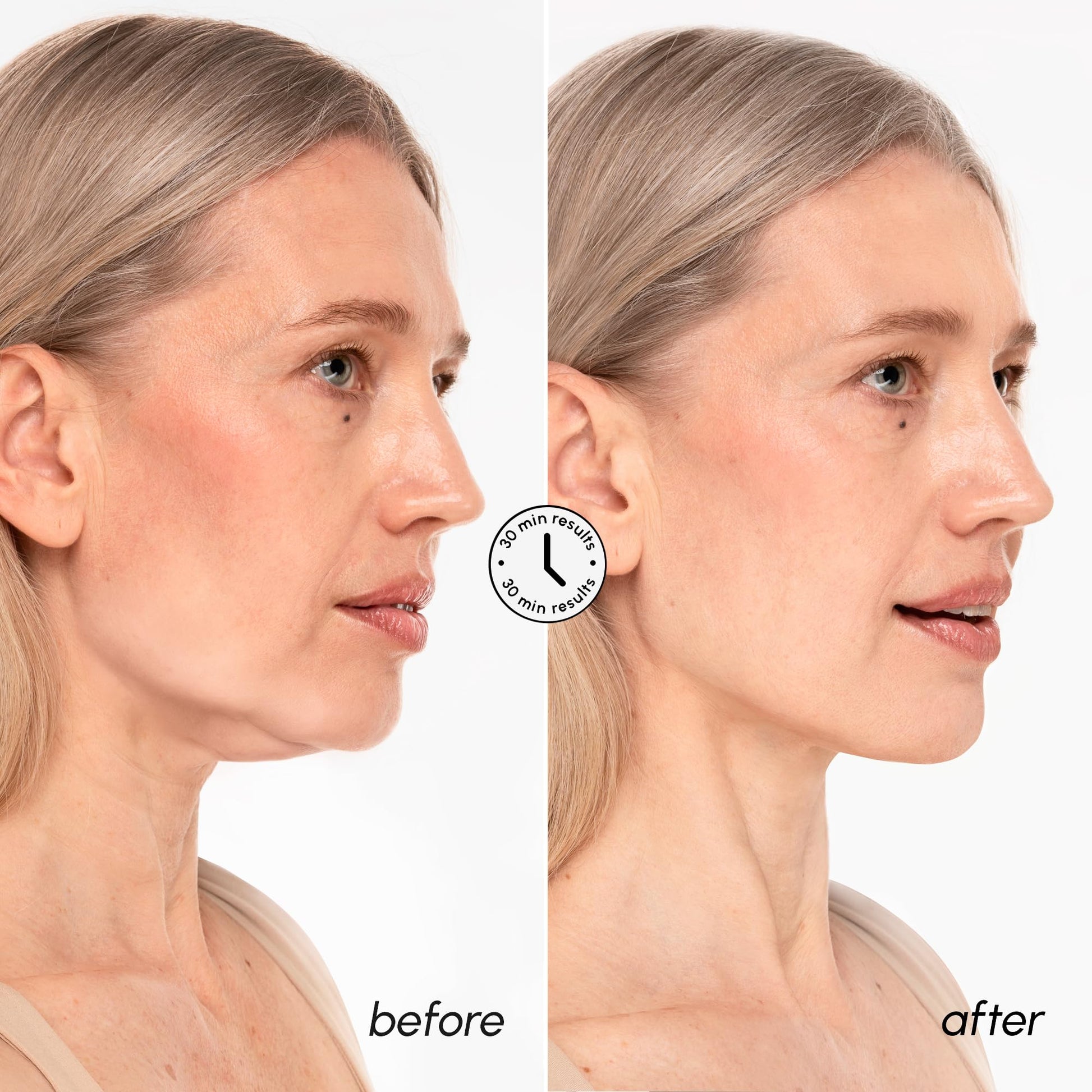 MAREE V Line Lifting Mask with 24K Gold – Deep Collagen Face Mask for Women – Jawline Shaper Mask with Retinol & Hyaluronic Acid – Neck Tightening & Firming - Double Chin Strap for Face Lift - Medaid International