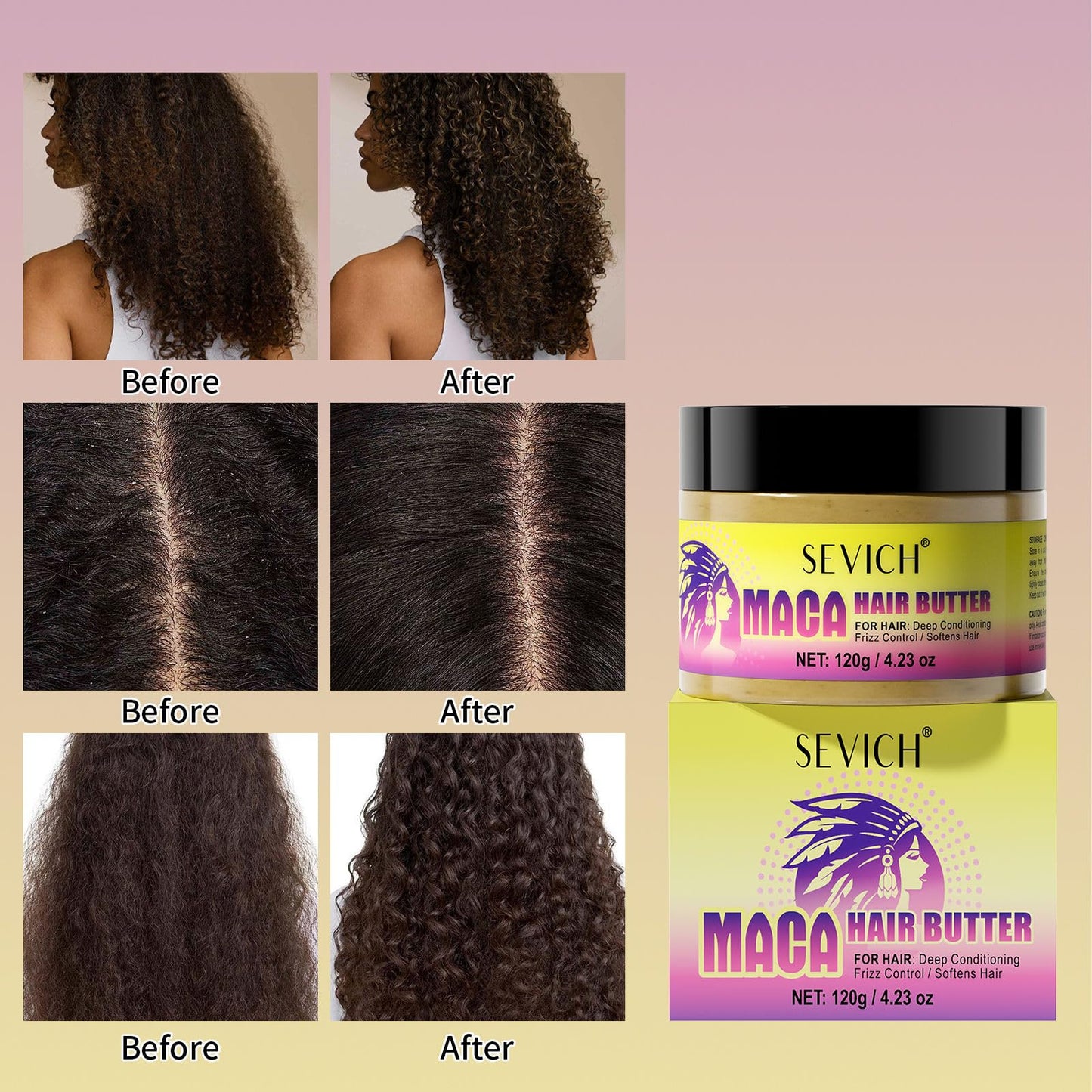 SEVICH Maca Root Powder Hair Butter Oil, Hair Oils for Hair Growth,Black Maca Hair Mask for Women & Men, Enhance Scalp Vitality, Relieve Dry Scalp, Keep Scalp Moisturized and Healthy, 120g - Medaid International