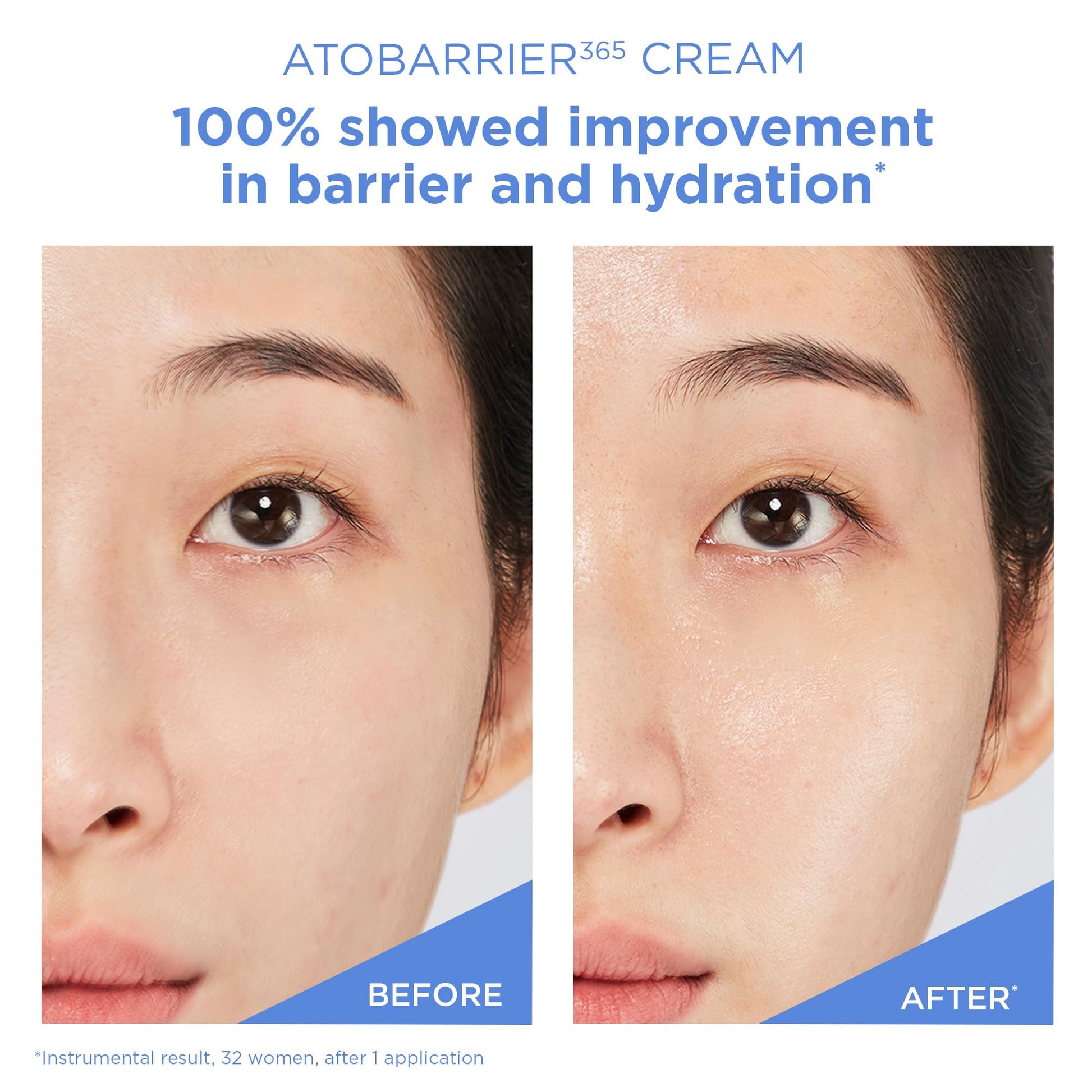 AESTURA ATOBARRIER365 Cream + Facial Mist - Medaid International