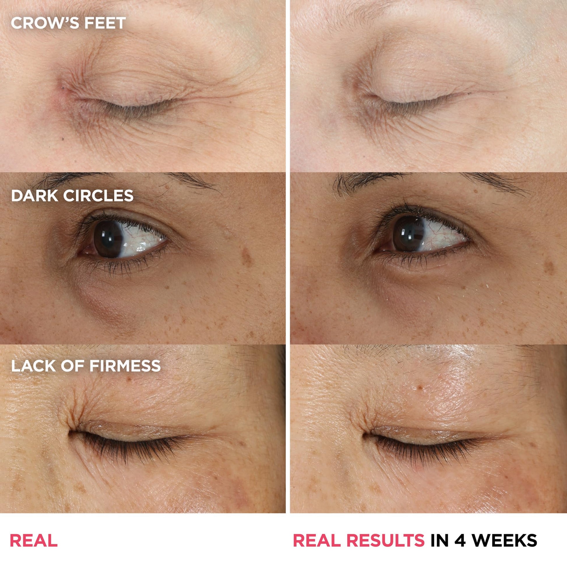 IT Cosmetics Confidence in an Eye Cream - Anti Aging Peptide Eye Cream for Dark Circles & Wrinkles, Lightweight 48HR Hydration, 2% Super Peptide Concentrate, Smooth & Brighten Undereye - 0.5 fl oz - Medaid International