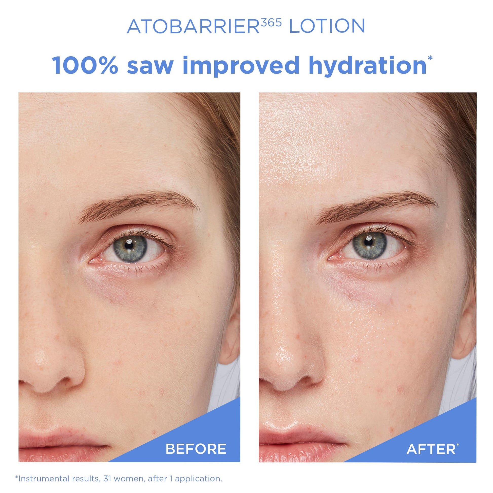 AESTURA ATOBARRIER365 Lightweight Korean Face Moisturizer with Ceramides | Strengthens Barrier, Fast-Absorbing Hydration, Suitable for Dry, Normal & Sensitive Skin, 90ML / 3.04 fl. Oz. - Medaid International