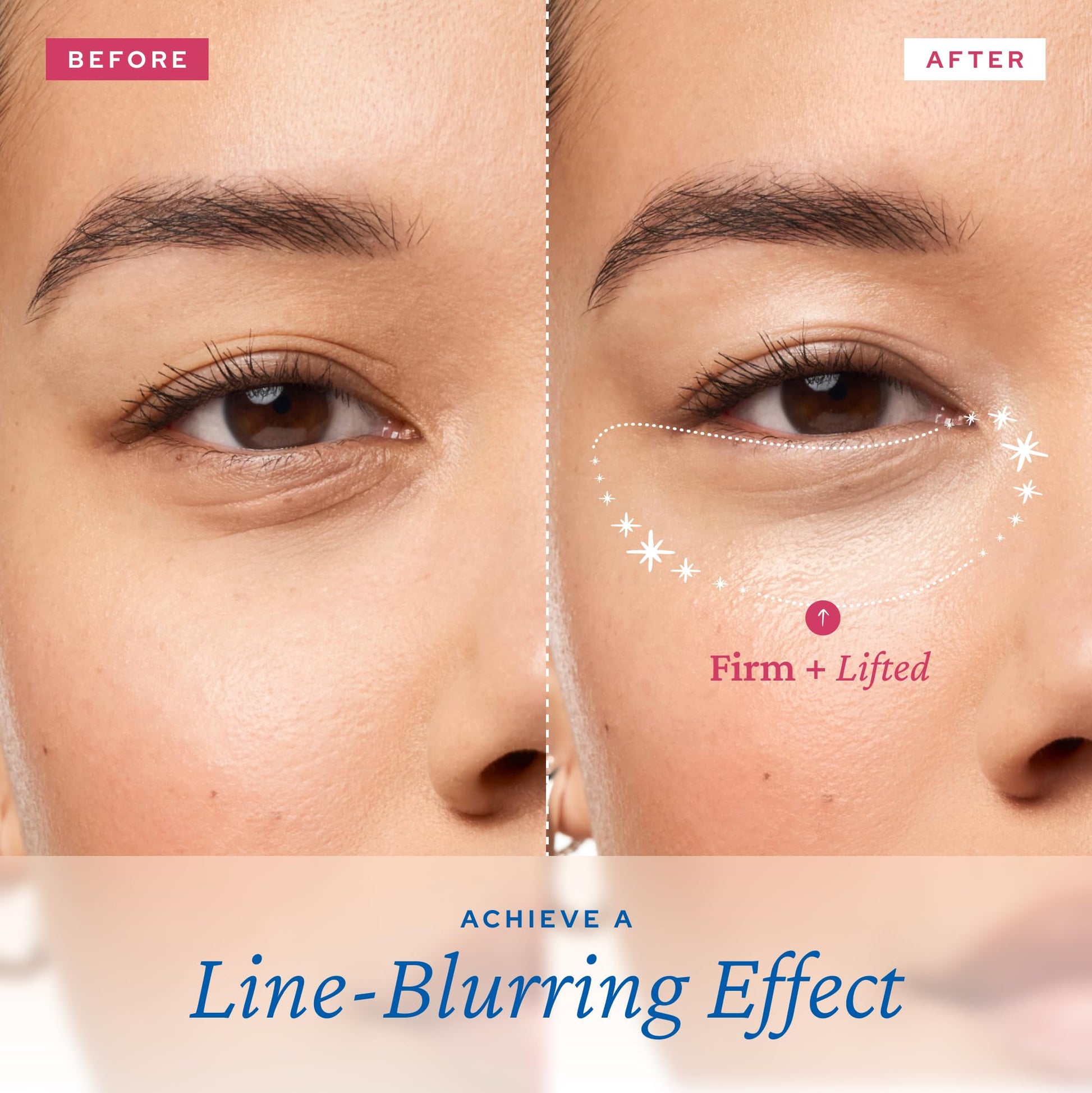 belif Retinol Firming Eye Serum – Aqua Bomb Lifting Eye Gel with Collagen & Bakuchiol for Puffiness, Fine Lines & Wrinkles, Peptide & Hyaluronic Acid, Korean Skin Care - Medaid International