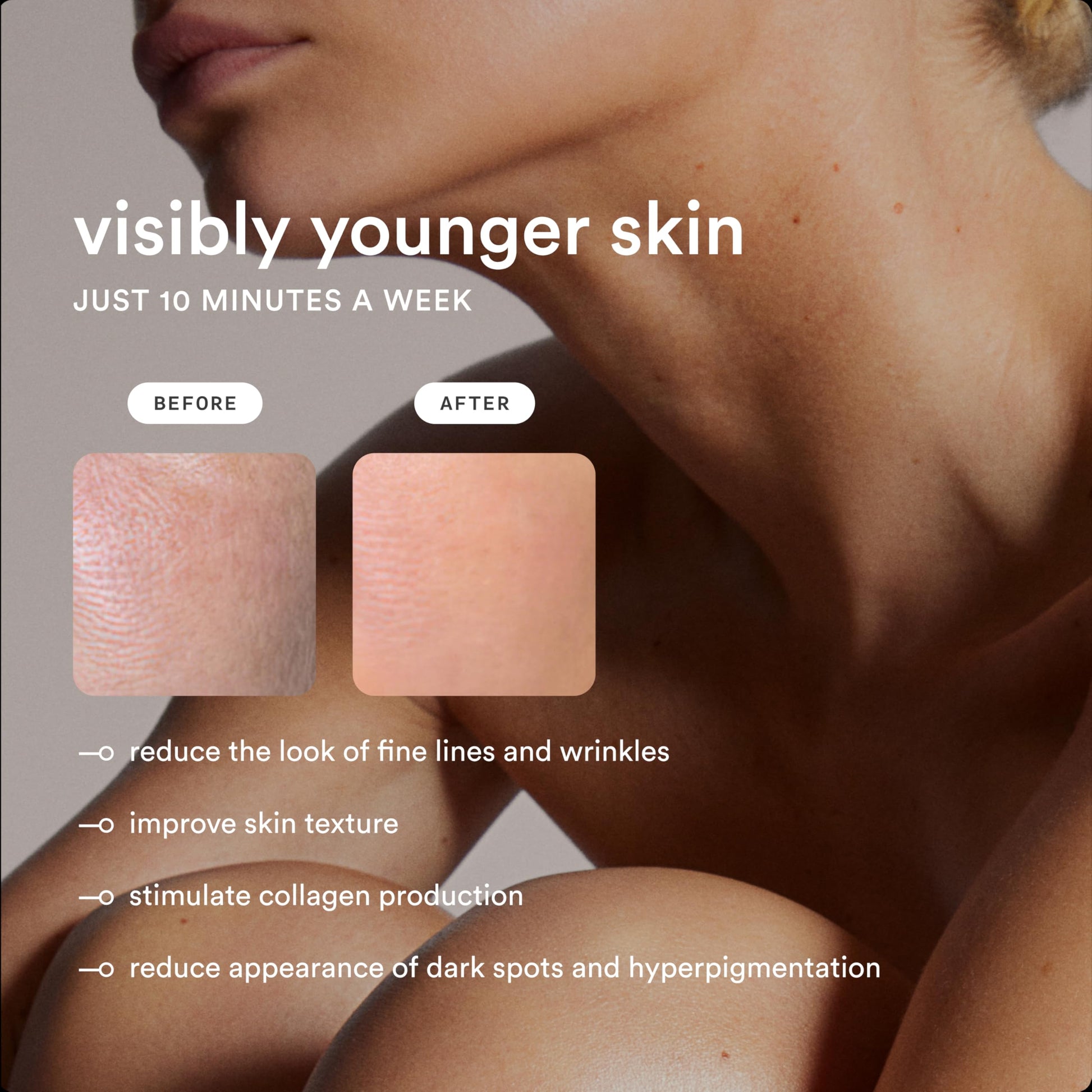 NEW Nood™ Flasher Pro + Slow-Grow Serum — IPL Laser Hair Removal Device for Women & Men + After Shave Serum to Slow Hair Regrowth While Reducing Ingrown Hair & Skin Irritation — Gloss White - Medaid International