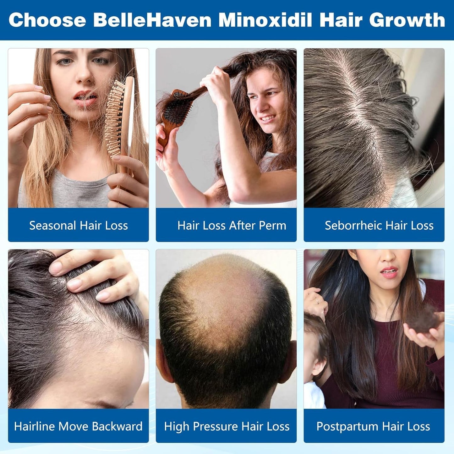 5% Minoxidil for Men Women, 100ML Minoxidil Hair Growth, Hair Regrowth Treatment Spray, Minoxidil Topical Solution Hair Growth Serum Stop Thinning and Loss Hair 2 Month Supply, for Beard, Hair - Medaid International
