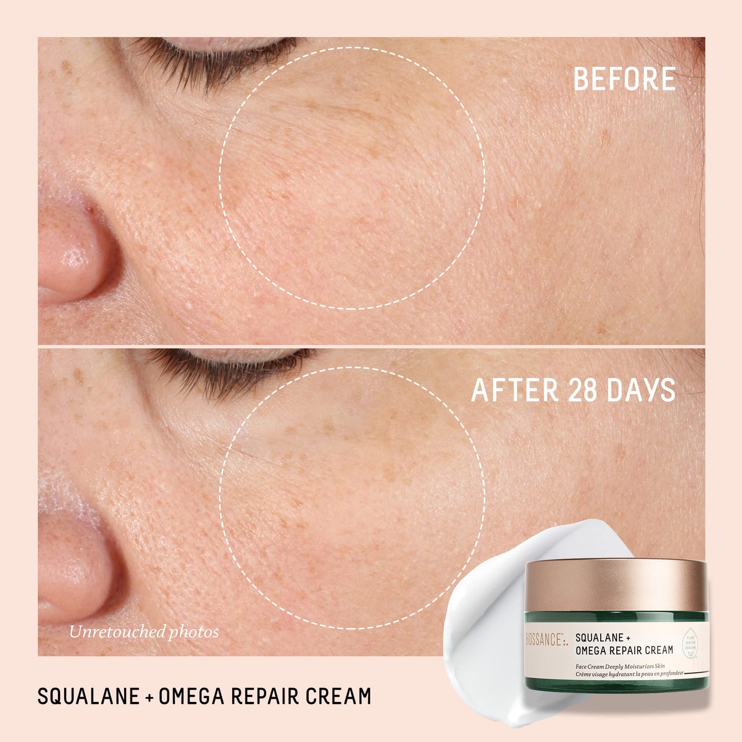 BIOSSANCE Squalane + Omega Repair Cream - Ultra-Moisturizing Face Cream - Skin Care with Hyaluronic Acid, Ceramides, Squalane - Ideal for Dry & Sensitive Skin, Intense Hydration Moisturizer - 1.7oz - Medaid International